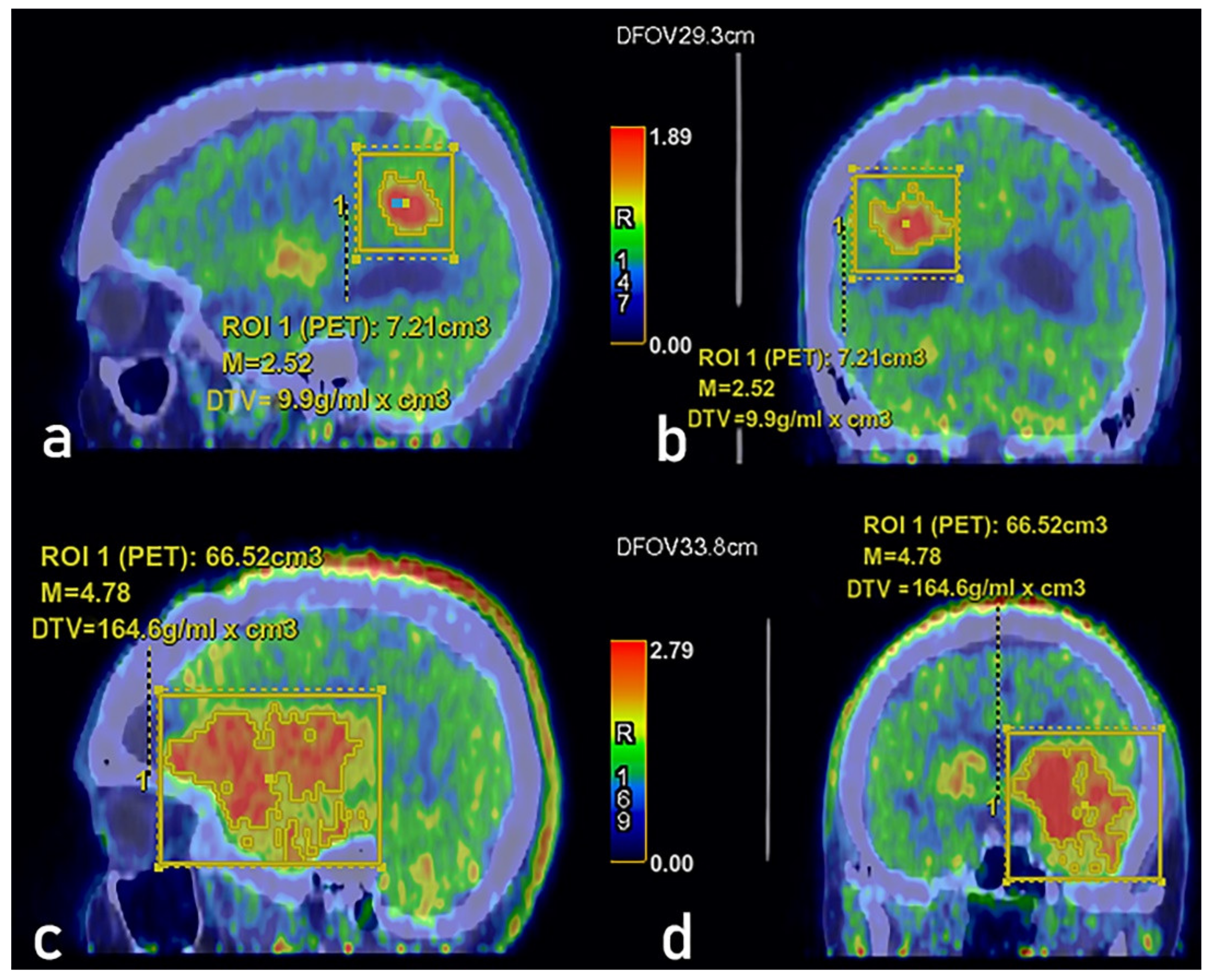 Cancers 13 04315 g001