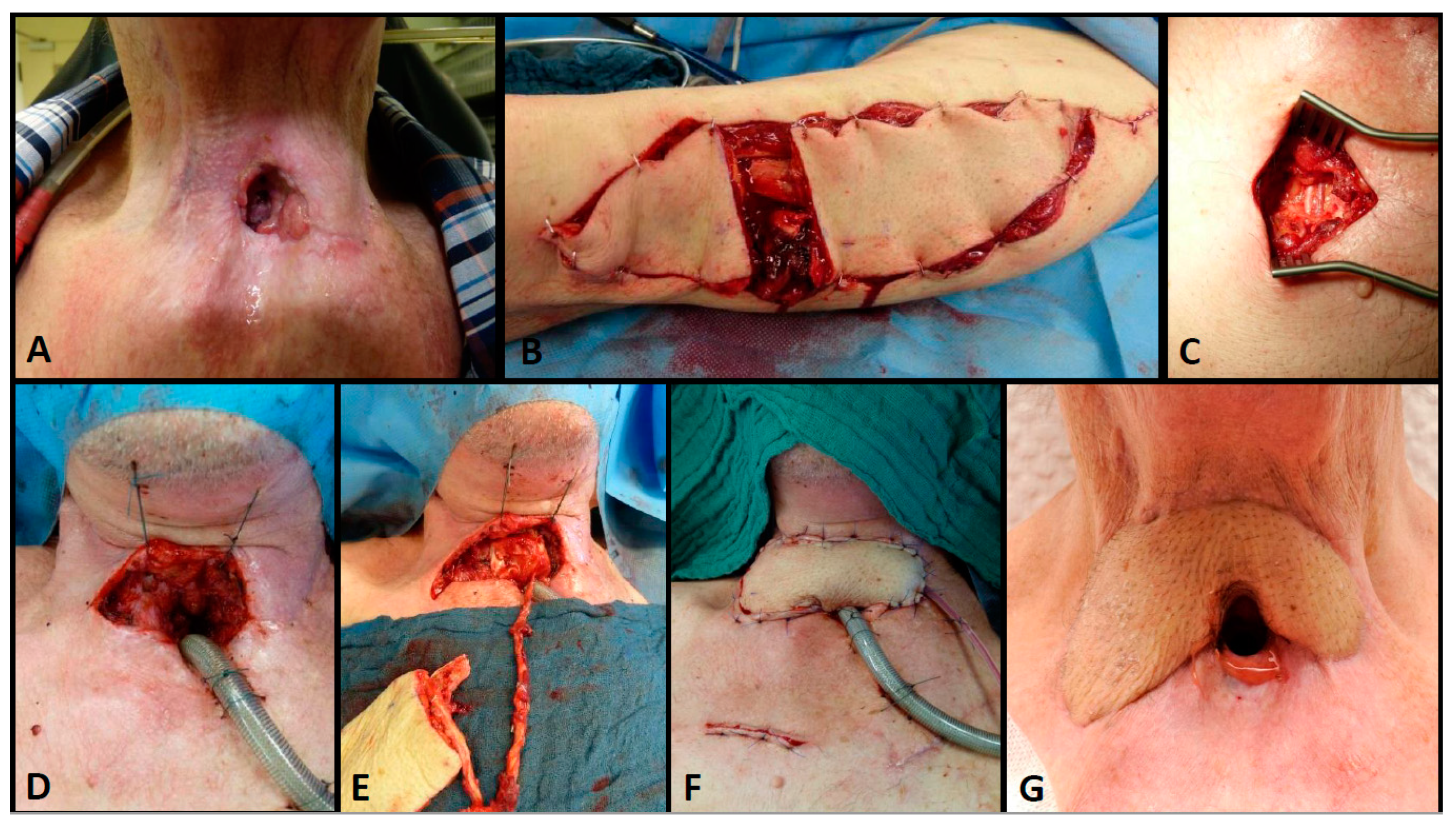 Cancers 13 04329 g003