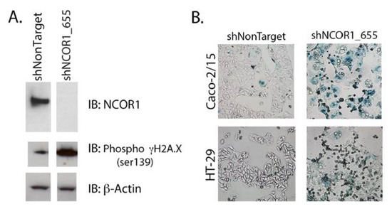 NCOR1 Sustains Colorectal Cancer Cell Growth and Protects