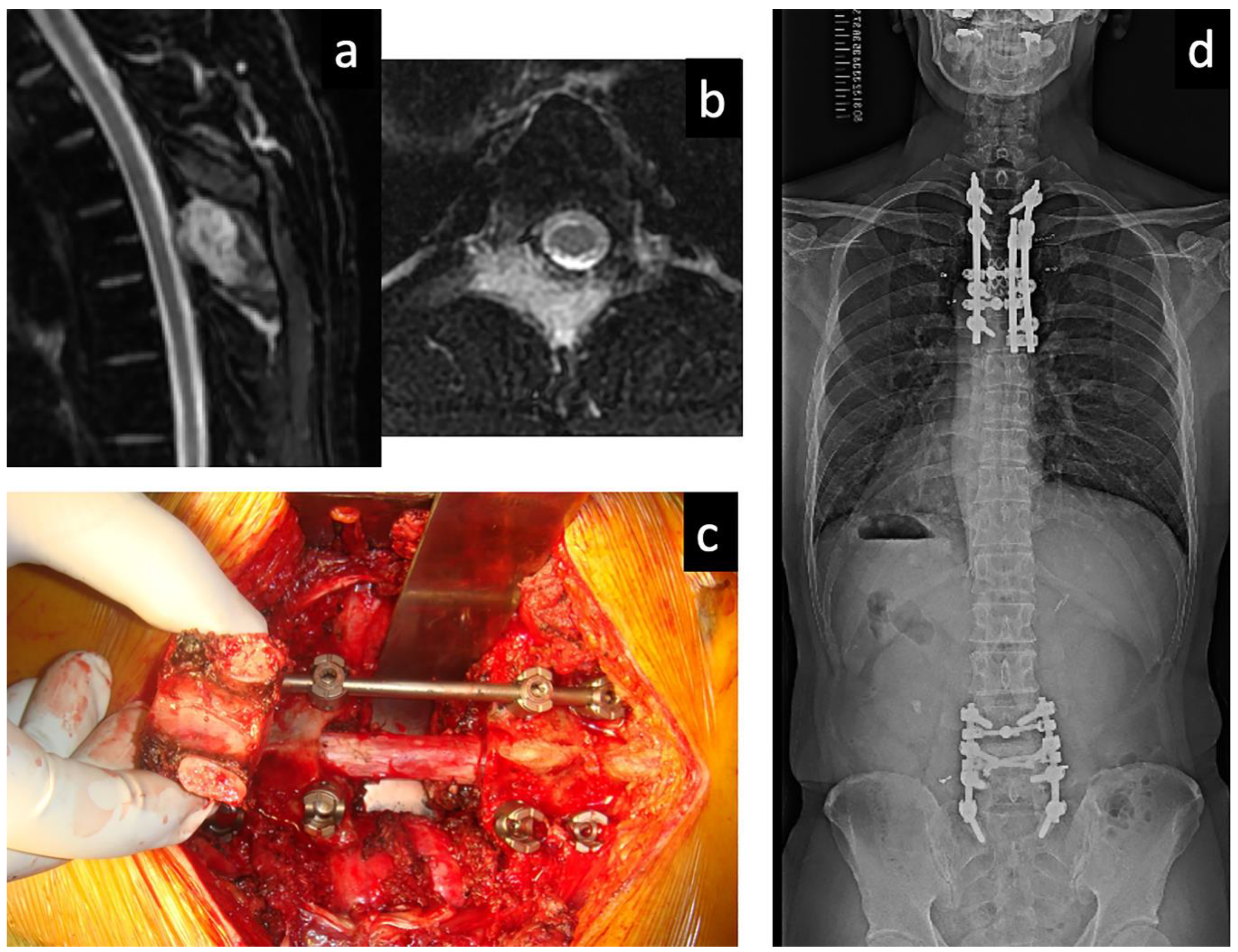 Cancers 13 04429 g001 550