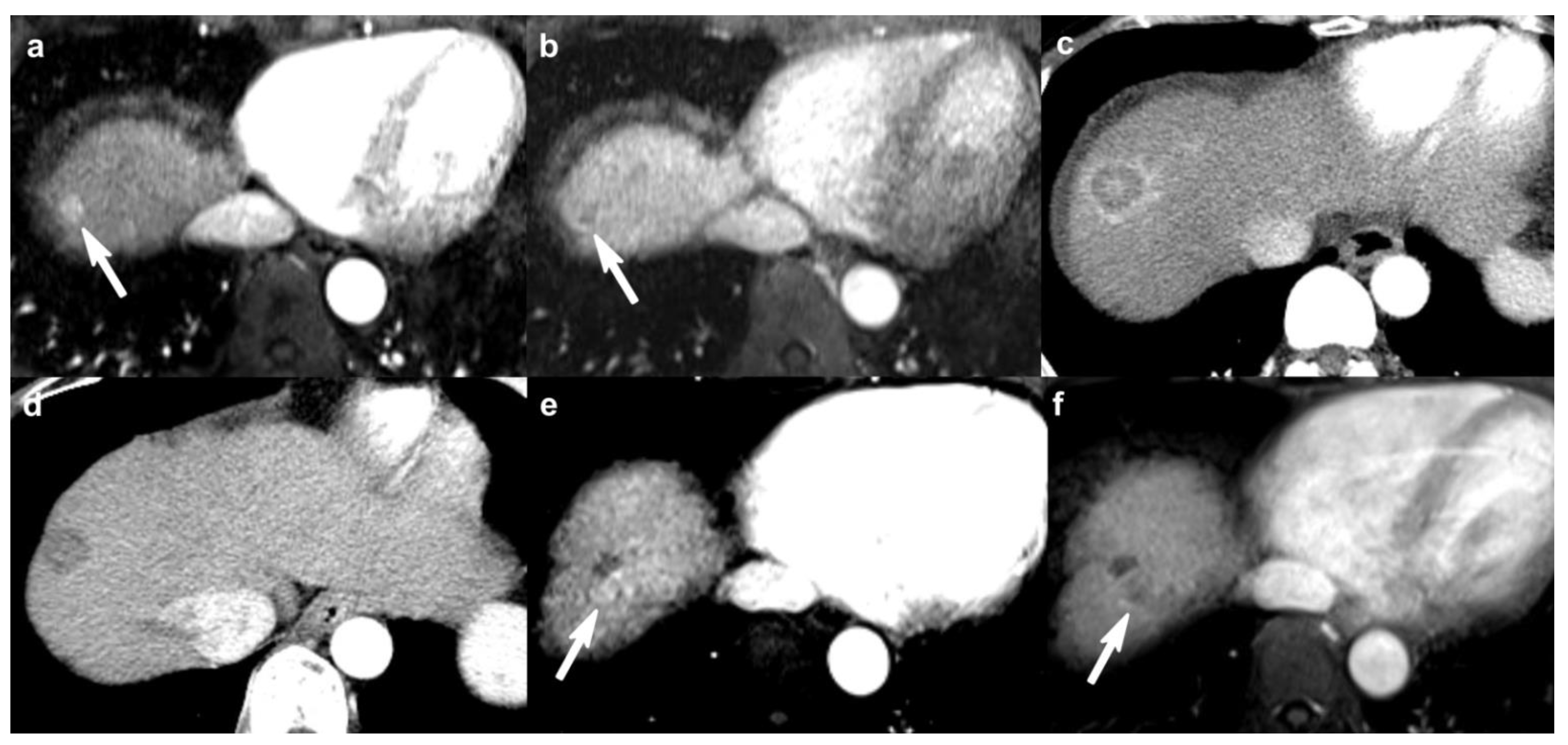 Cancers 13 04432 g003