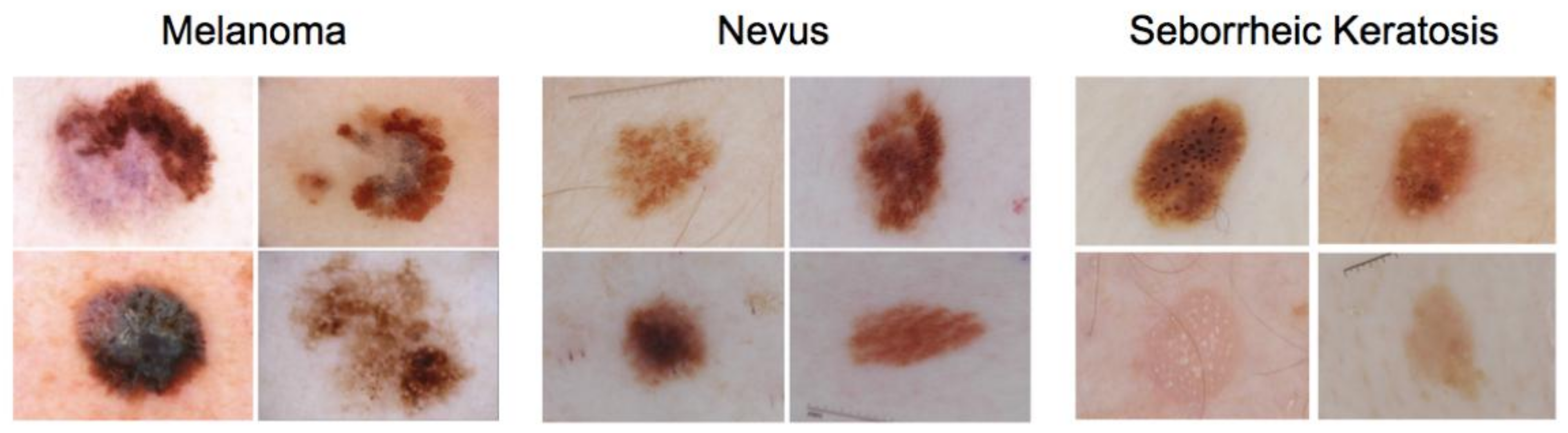 Cancers 13 04494 g001 550