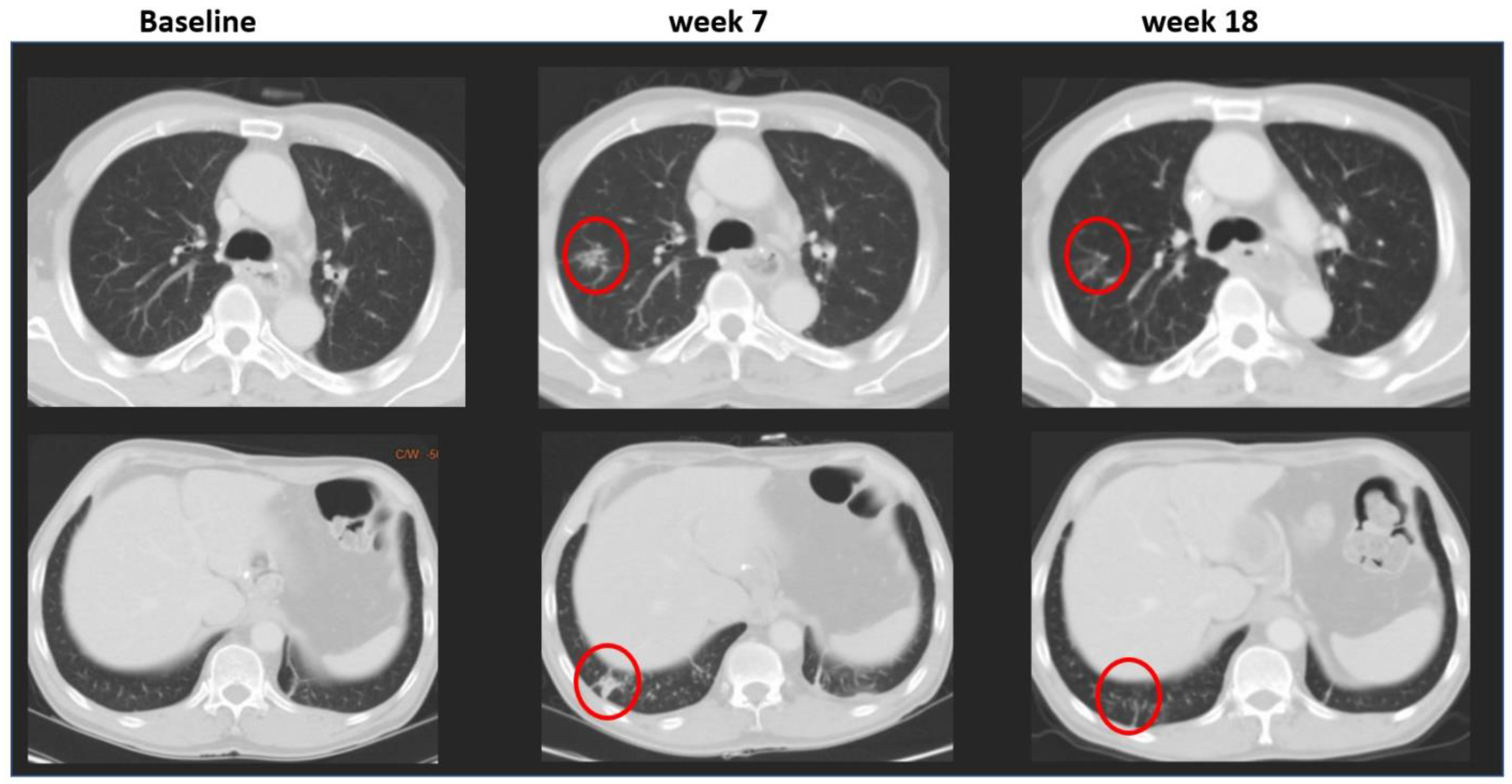 Cancers 13 04533 g004 550