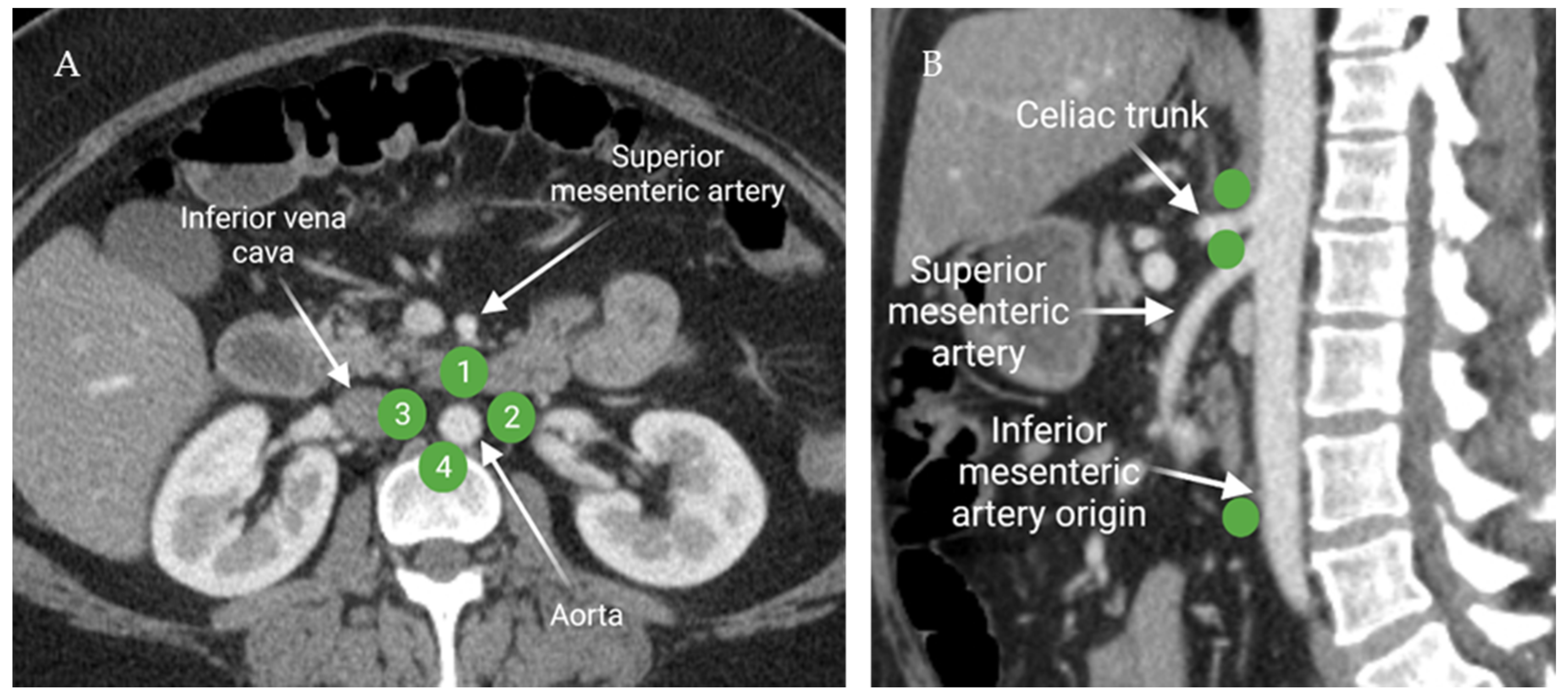 Cancers 13 04554 g006