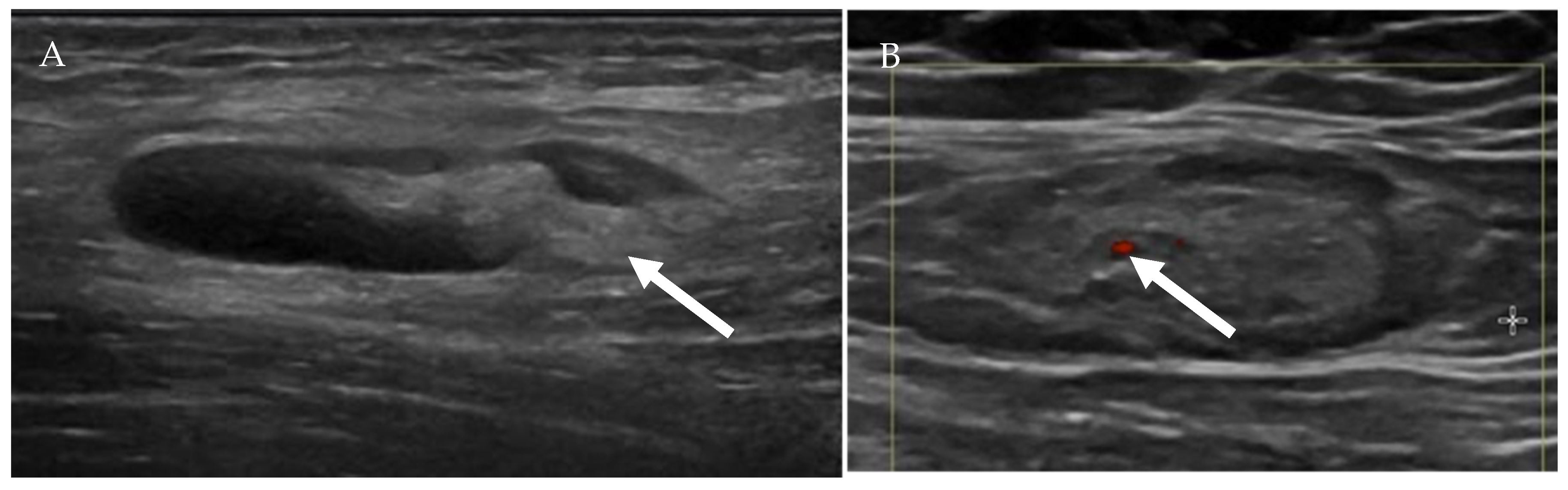 Cancers 13 04554 g008