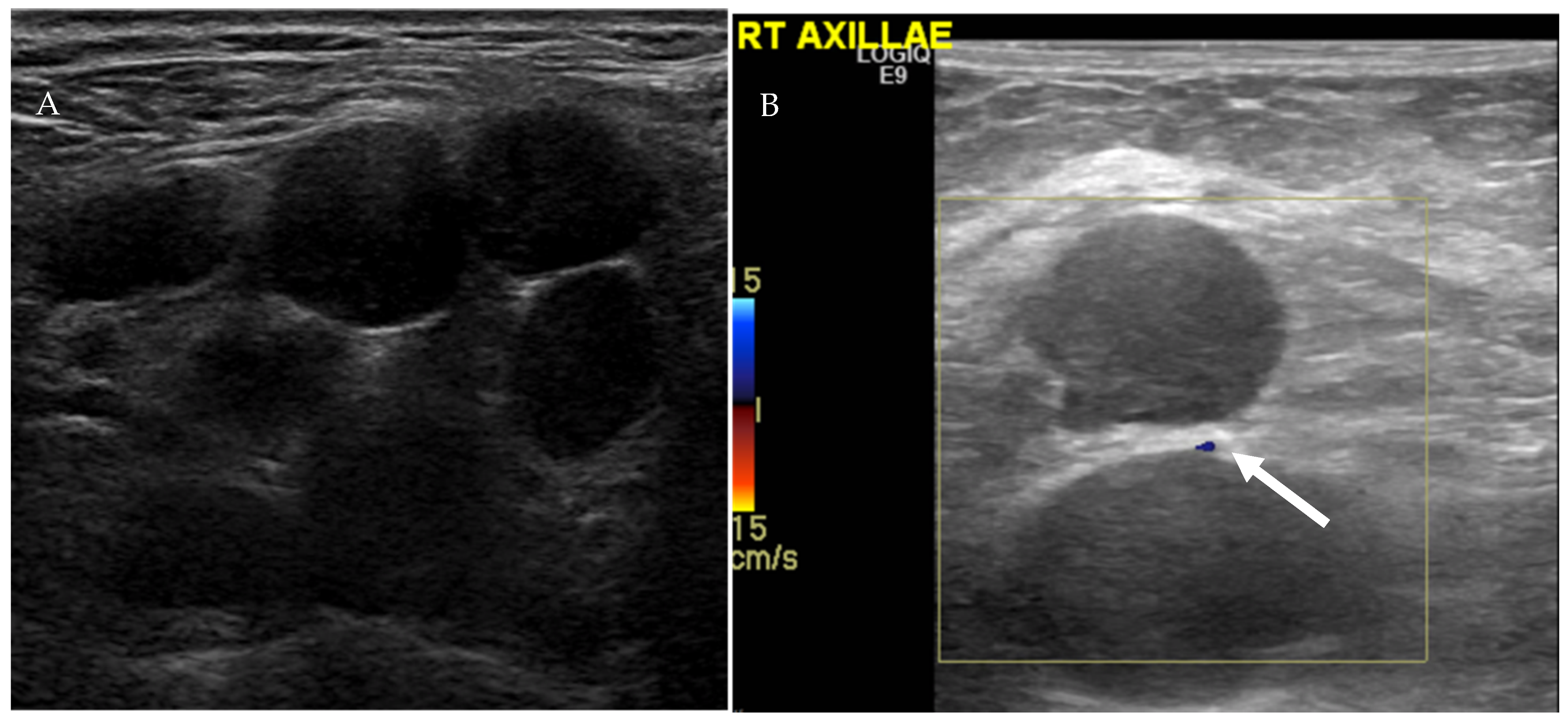 Cancers 13 04554 g009