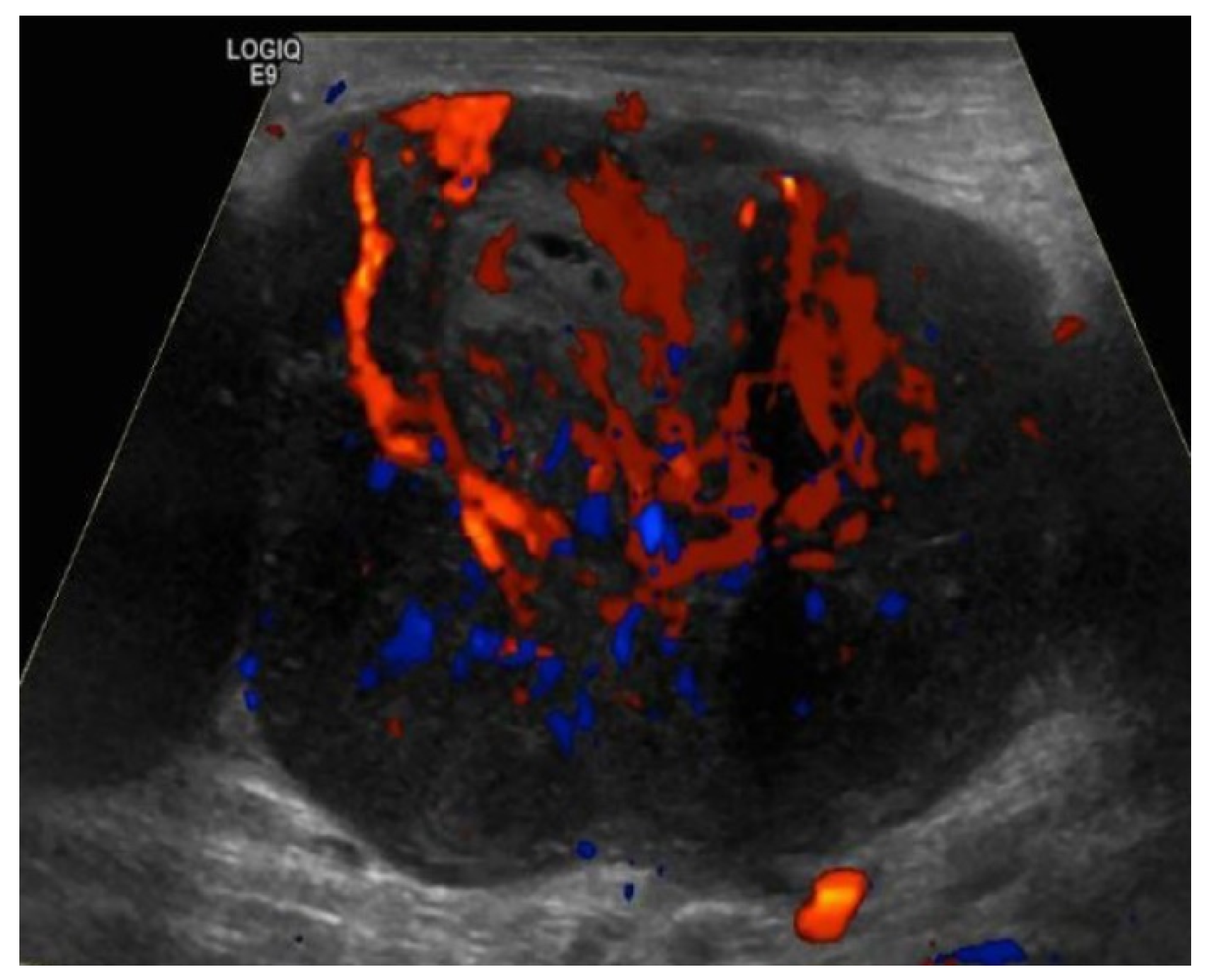 Cancers 13 04554 g010