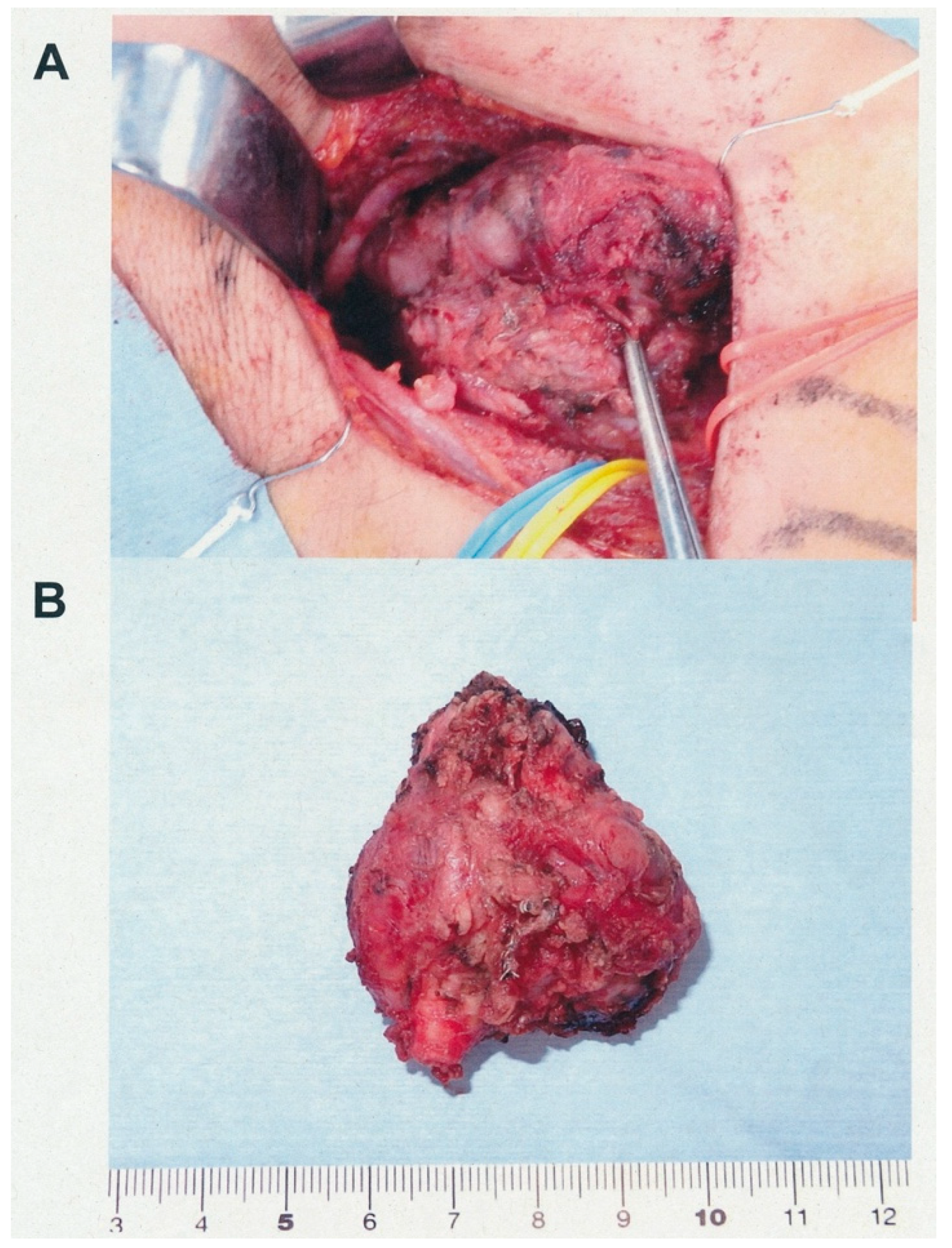 Cancers 13 04565 g002