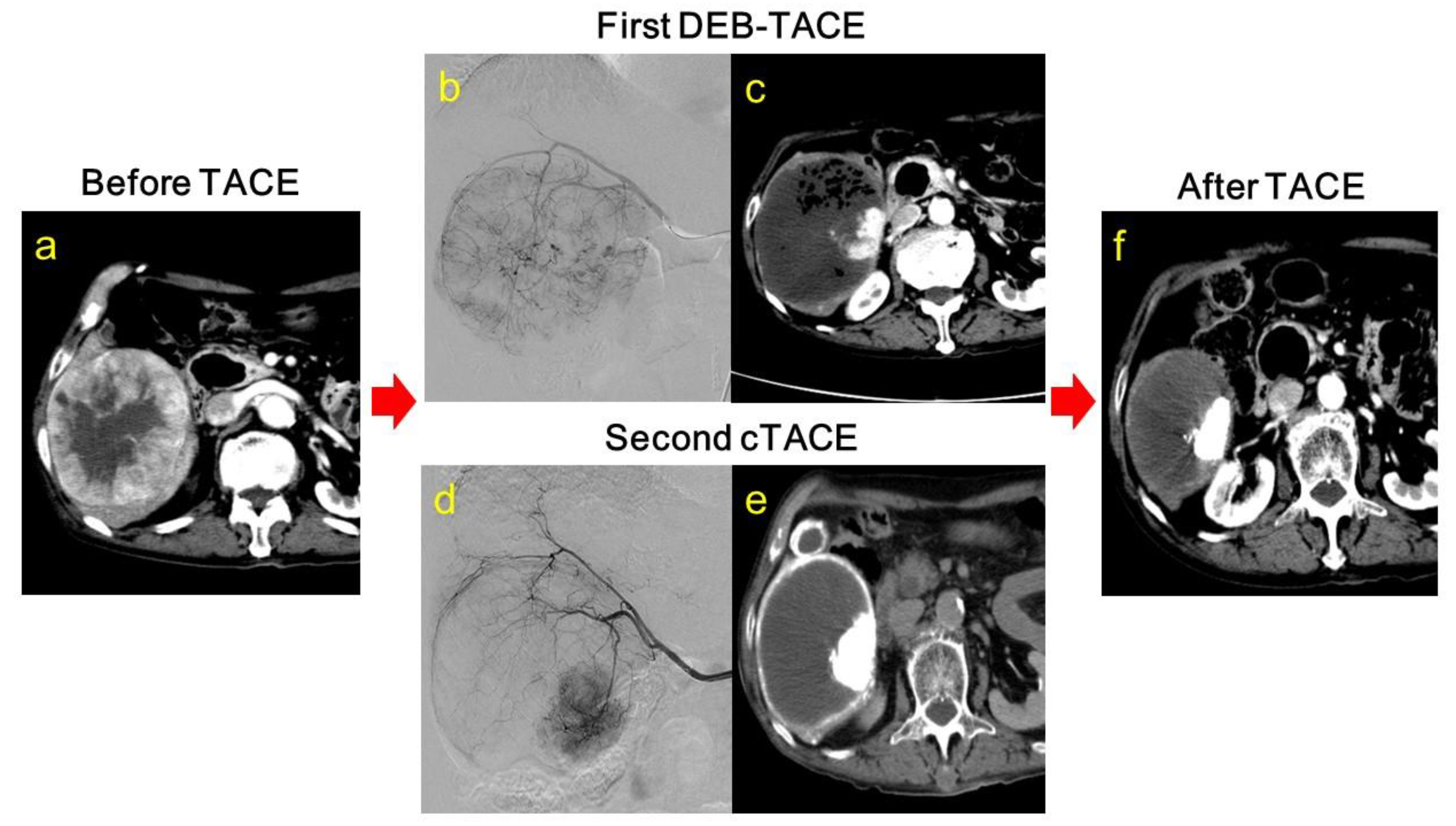 Cancers 13 04605 g002