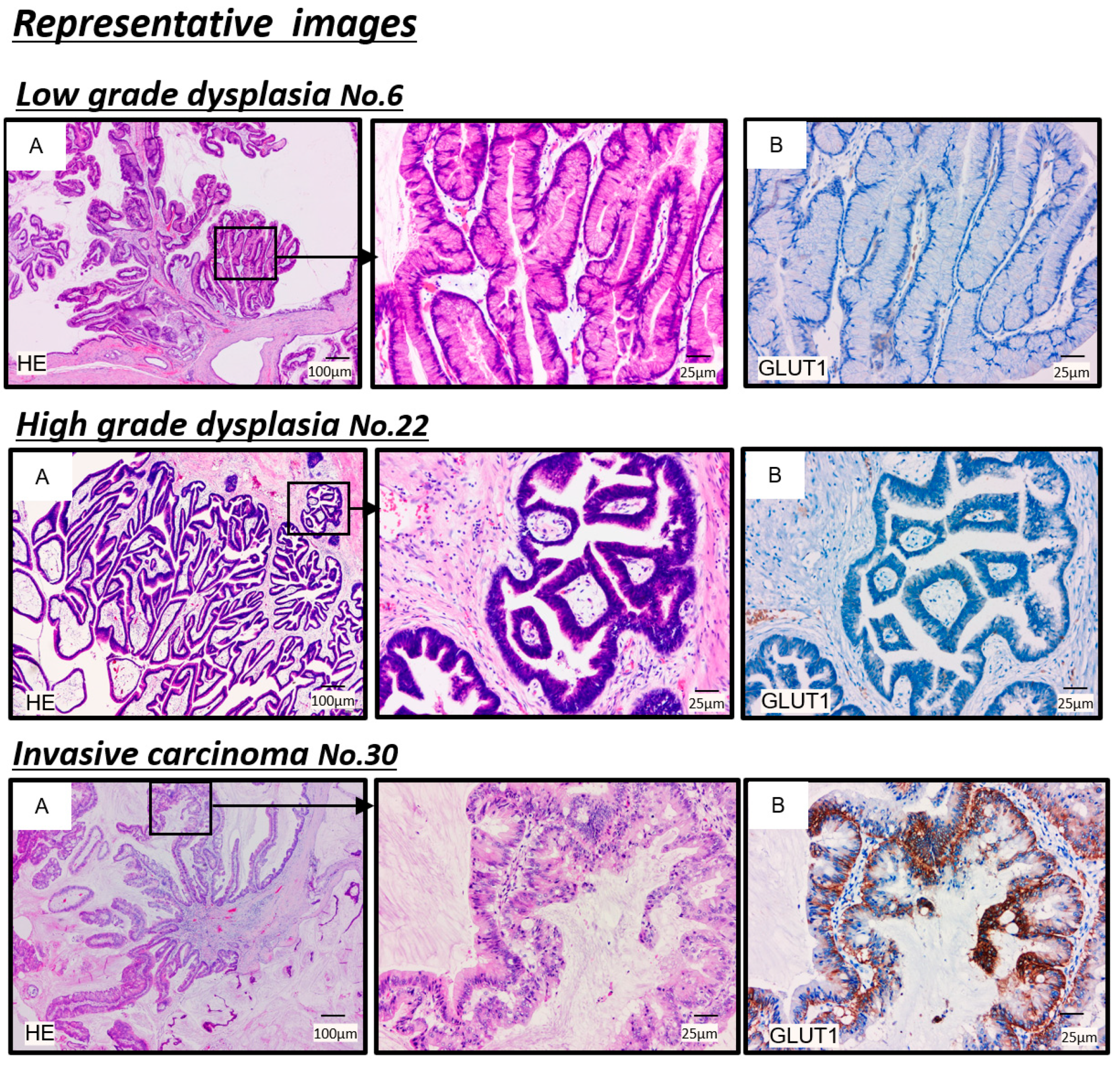 Cancers 13 04633 g004 Cancers 13 04633 g004