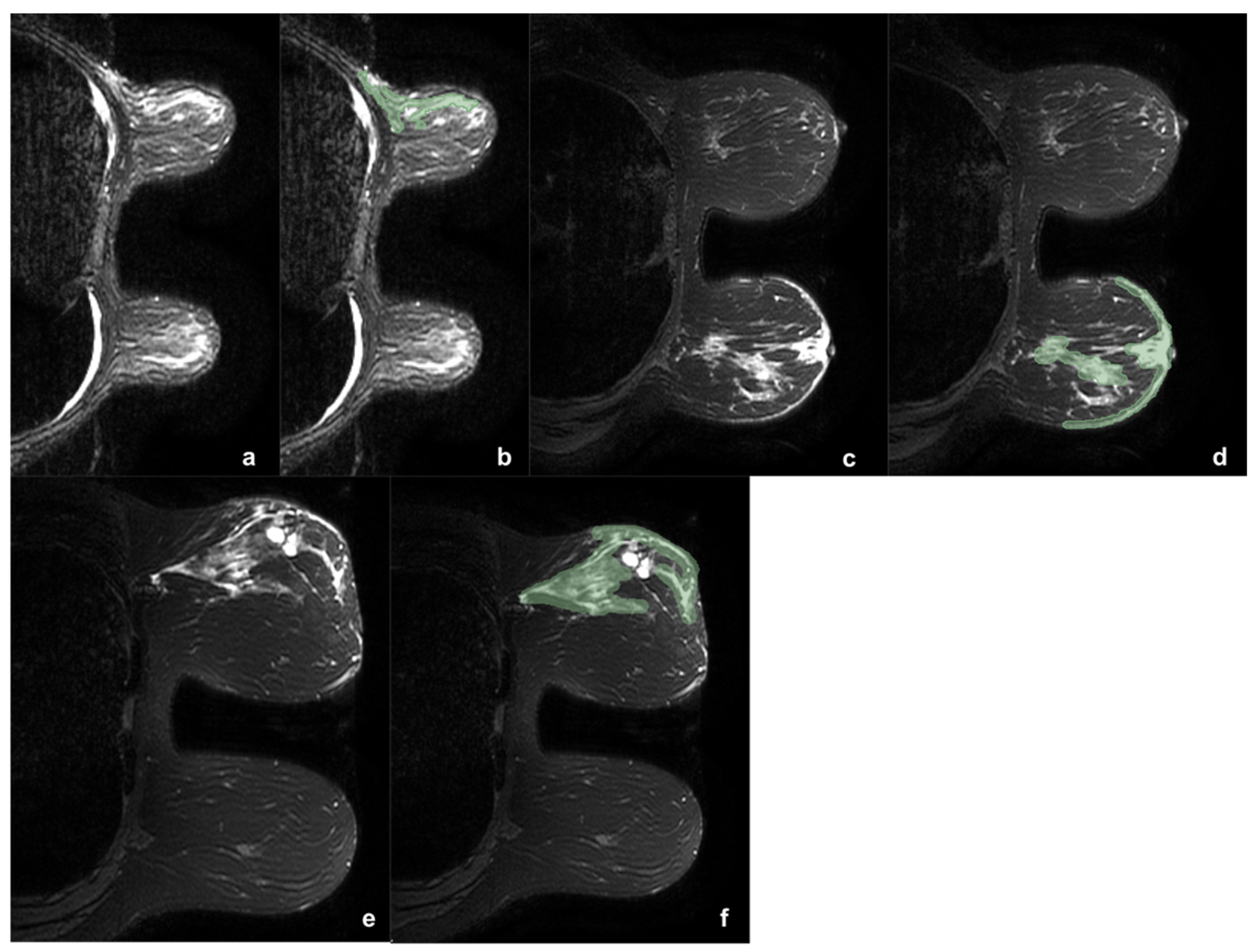 Cancers 13 04635 g001 Cancers 13 04635 g001