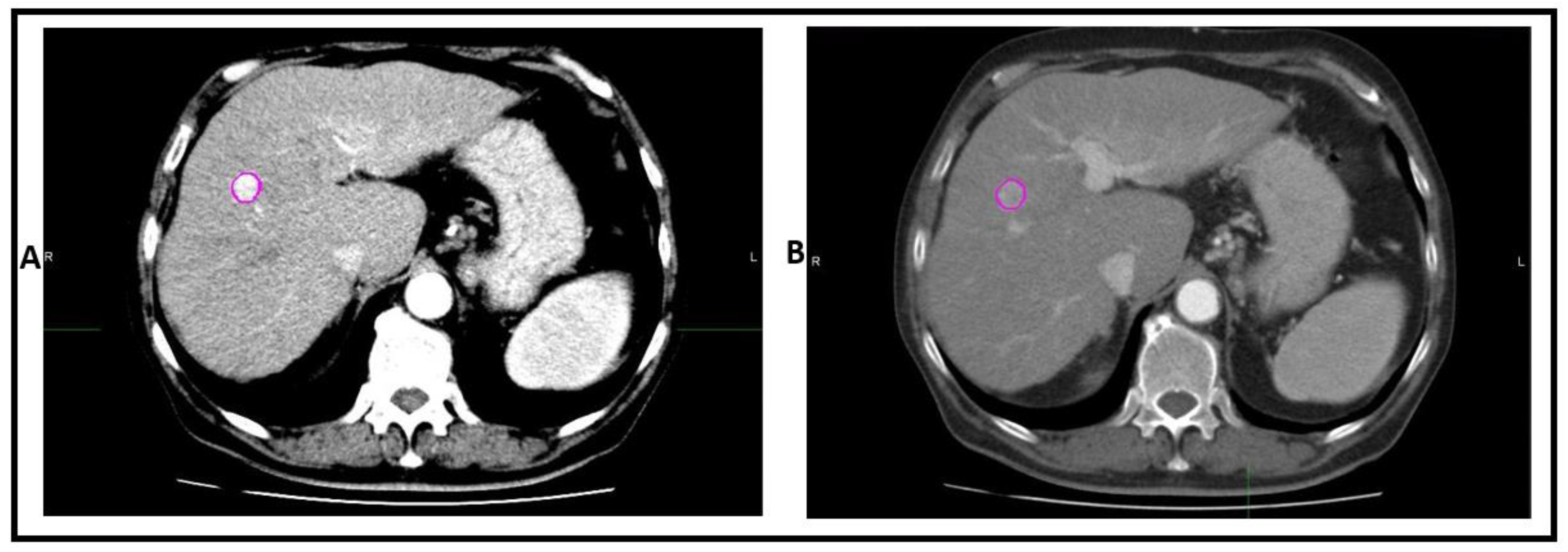 Cancers 13 04638 g002
