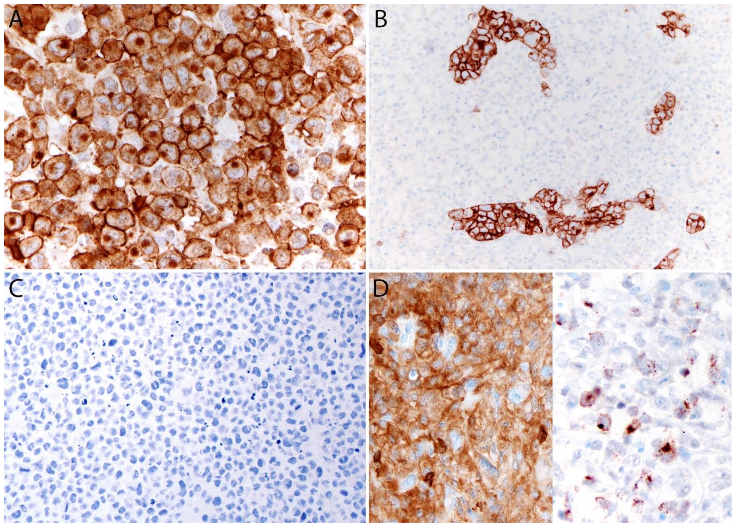 Cancers 13 04667 g004 Cancers 13 04667 g004