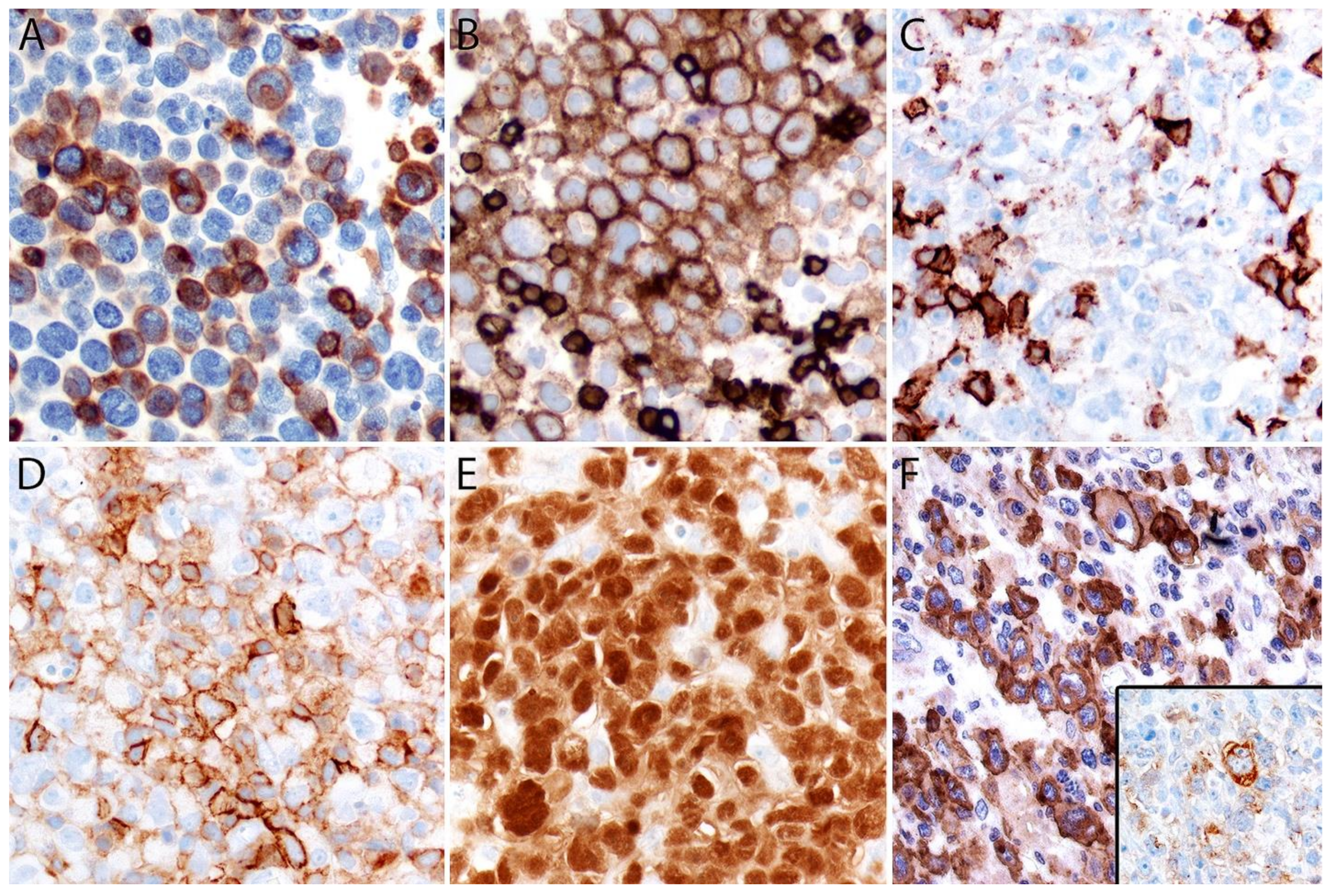 Cancers 13 04667 g005 Cancers 13 04667 g005