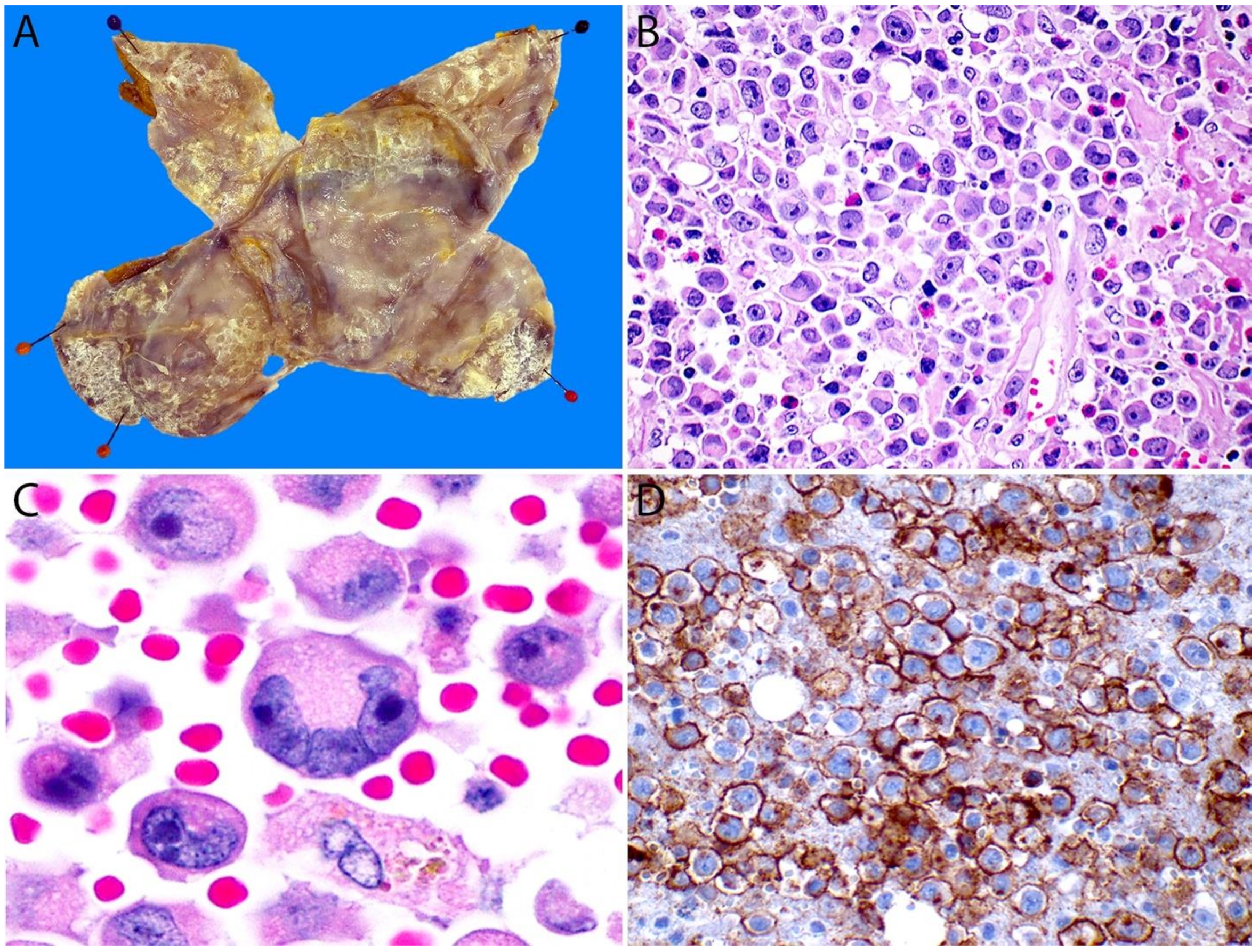 Cancers 13 04667 g016 Cancers 13 04667 g016