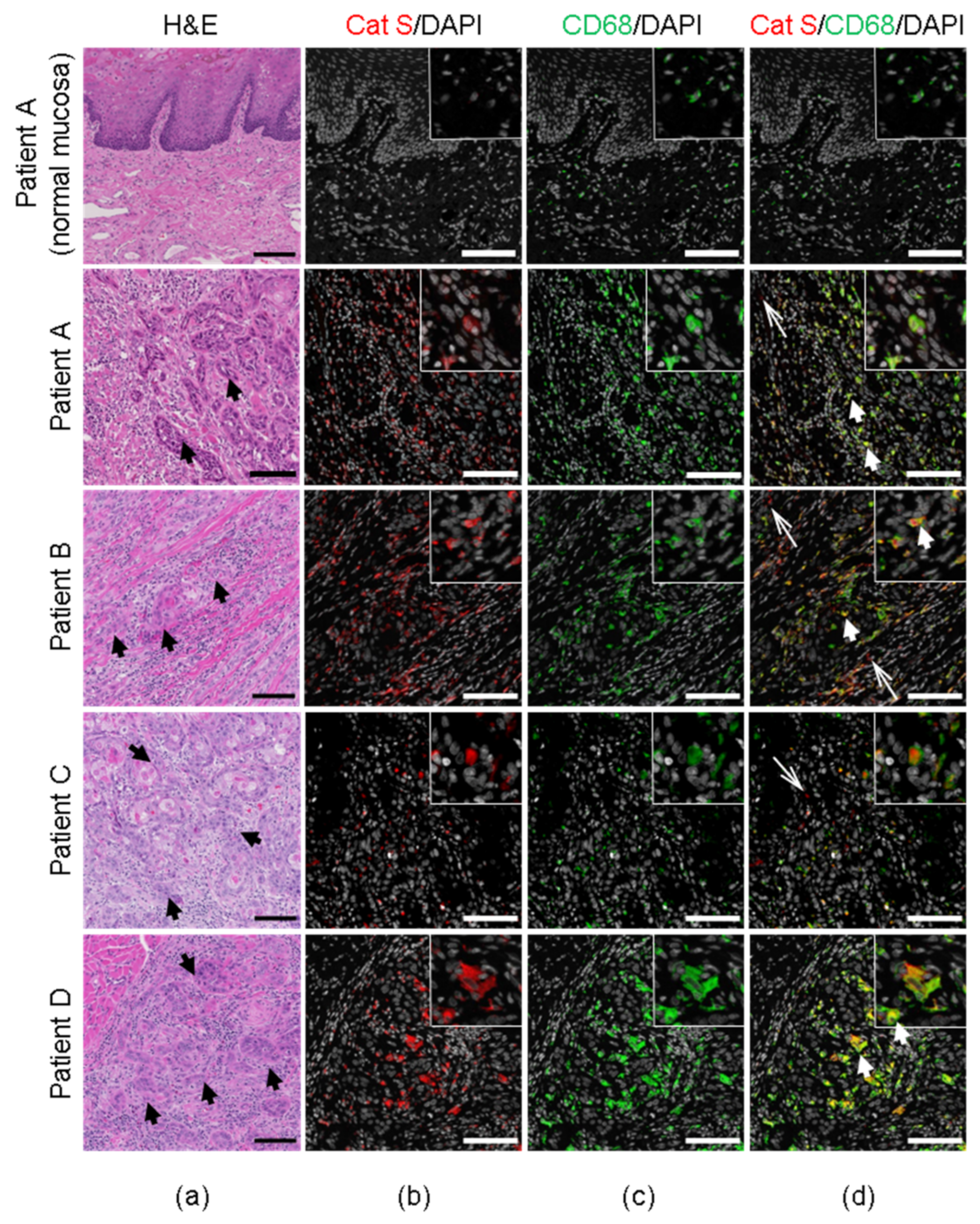 Cancers 13 04697 g002