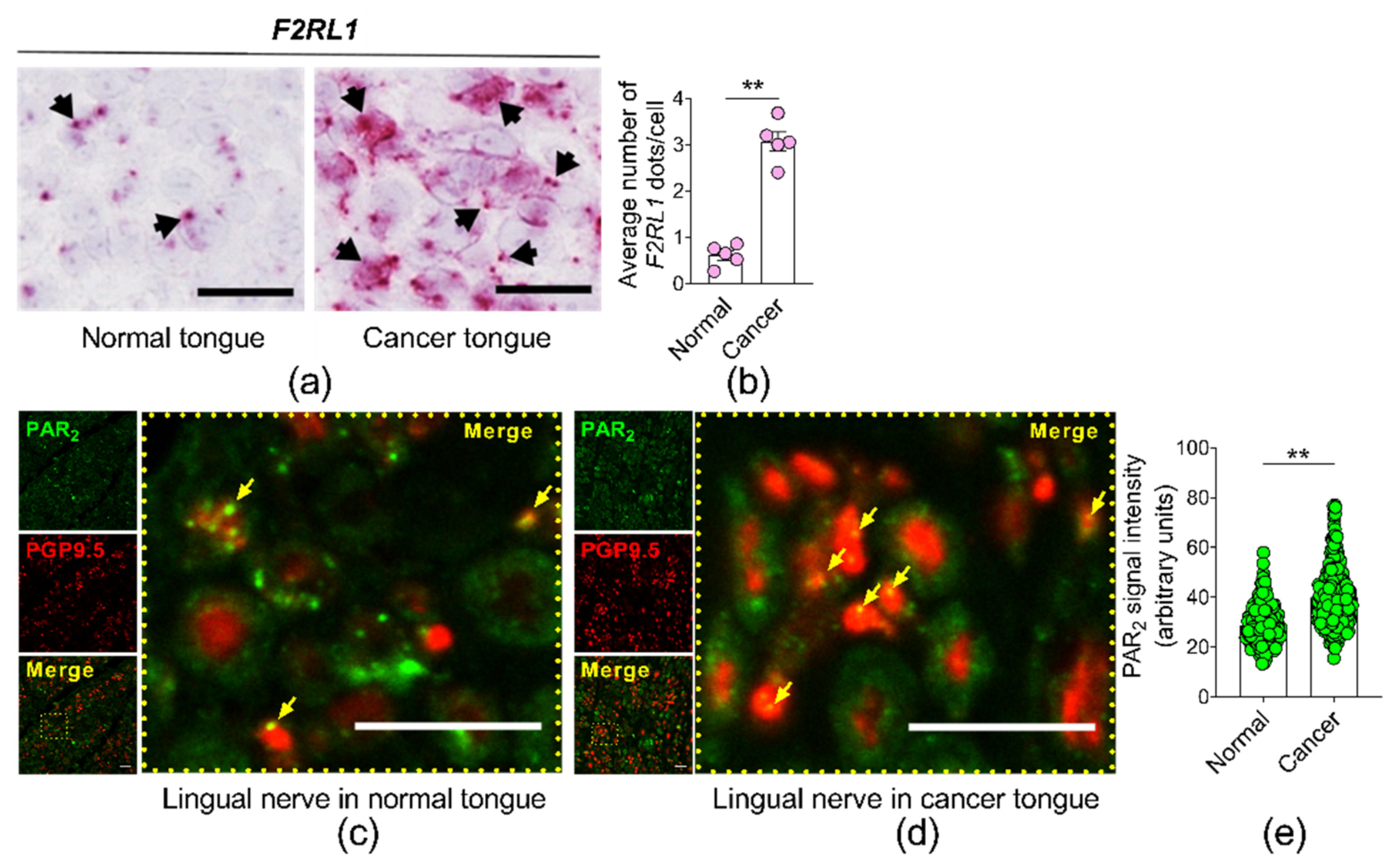 Cancers 13 04697 g004