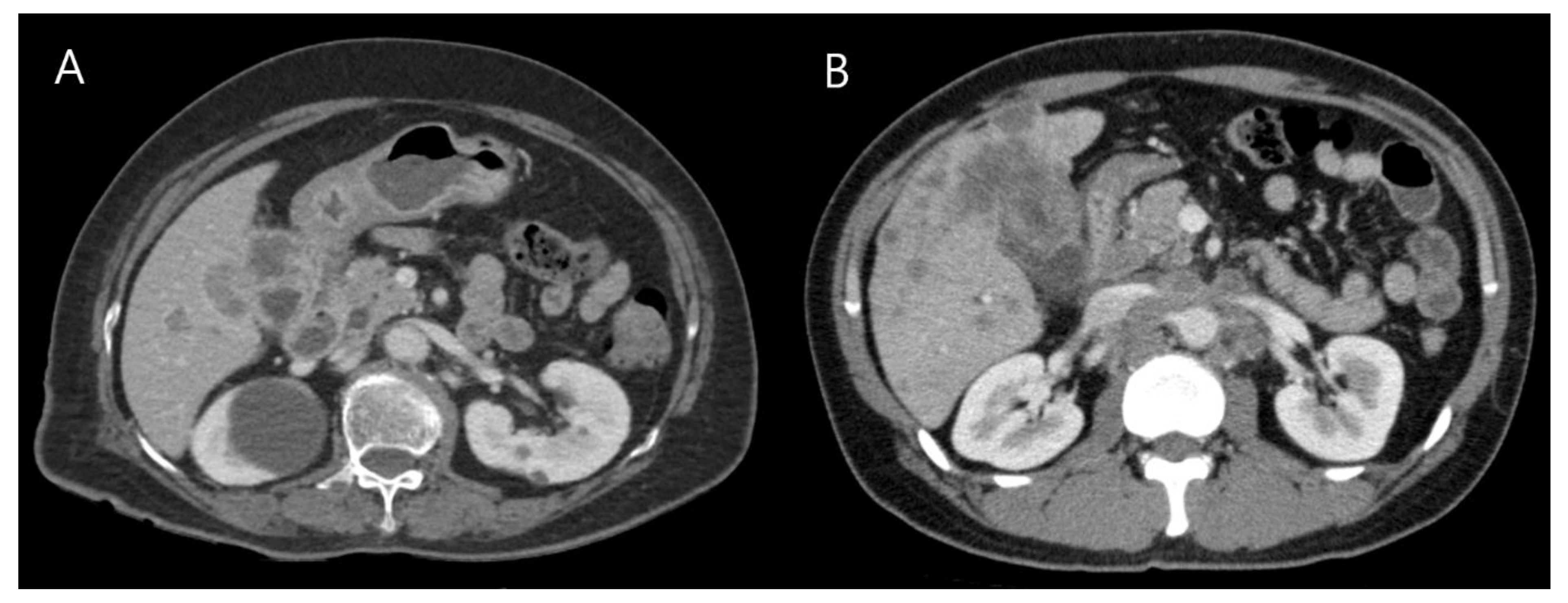 Cancers 13 04713 g001