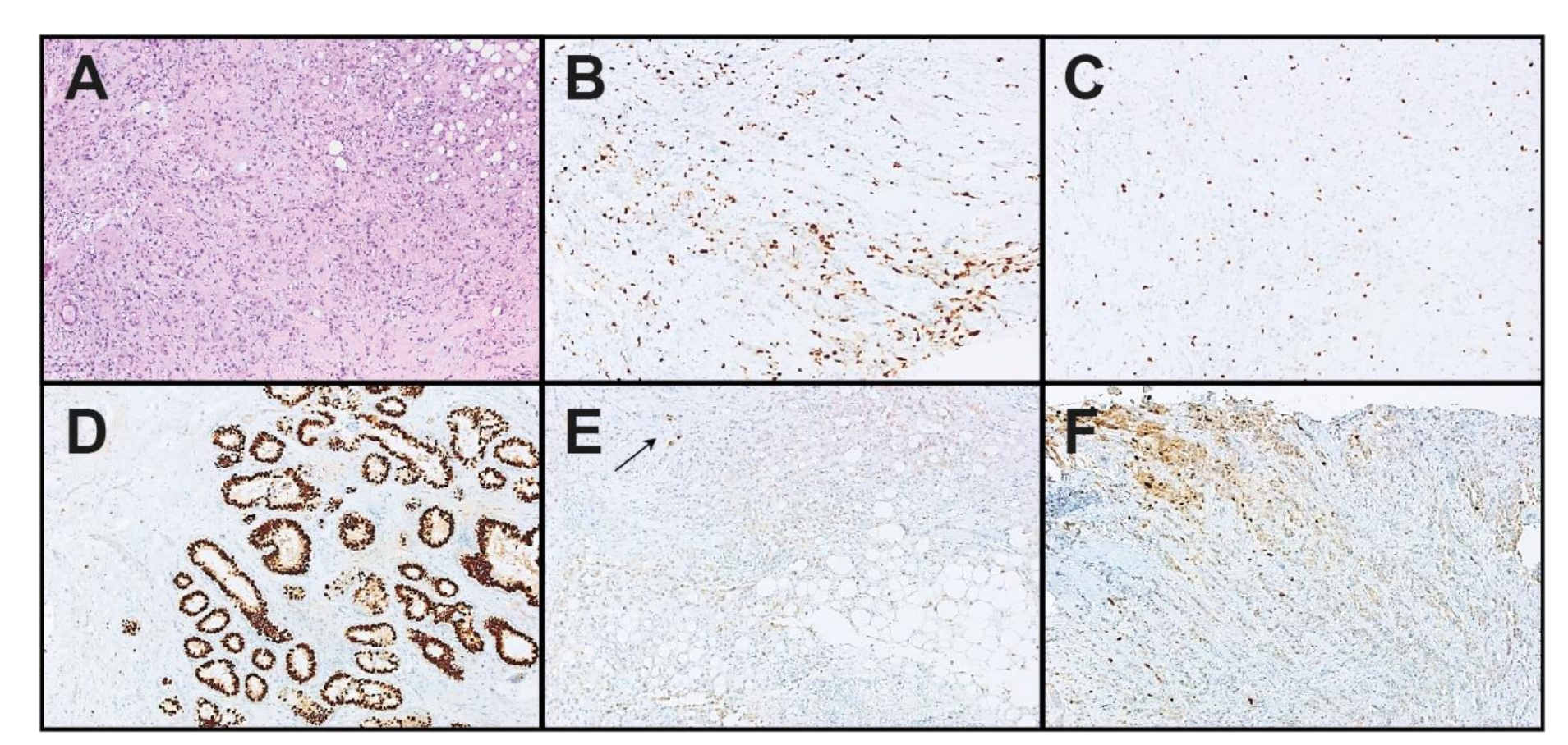 Cancers 13 04718 g002