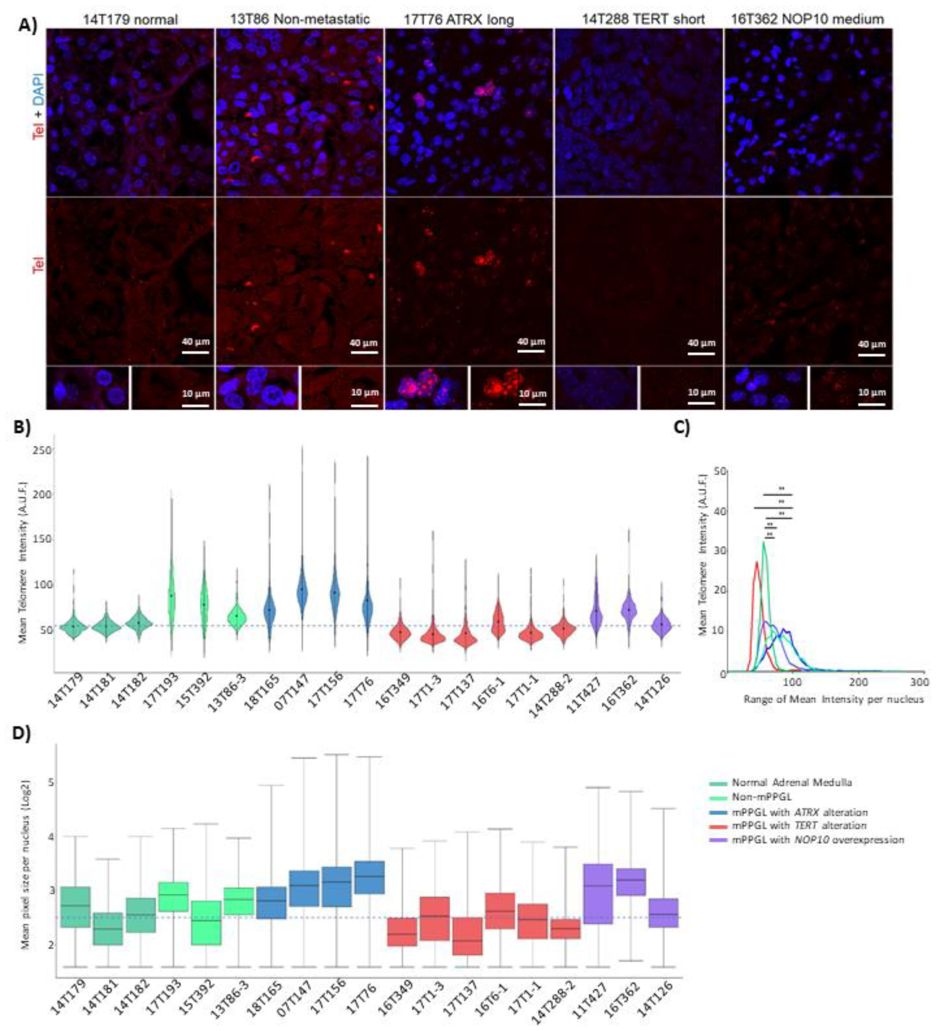 Cancers 13 04758 g005