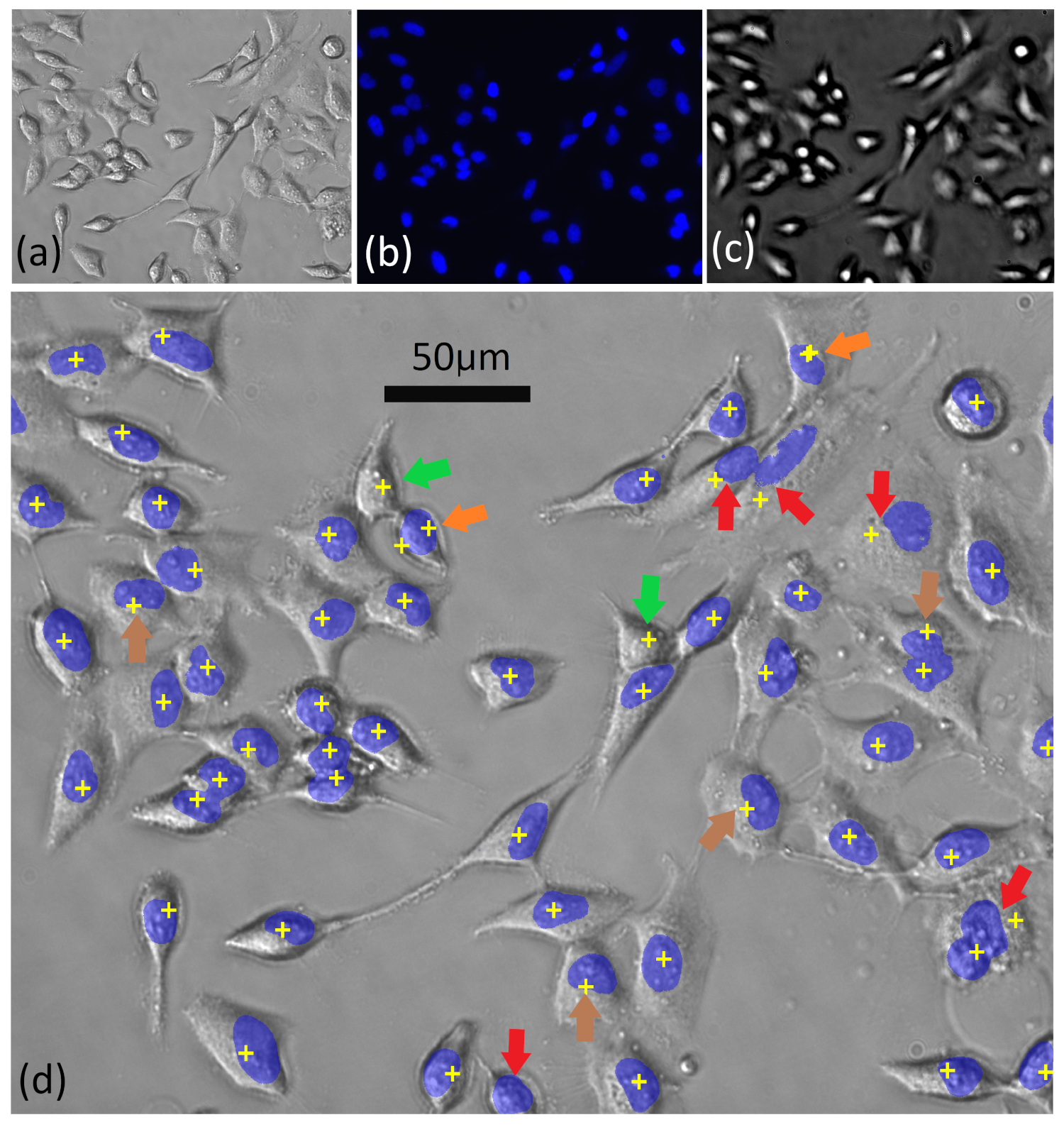 Cancers 13 04767 g001