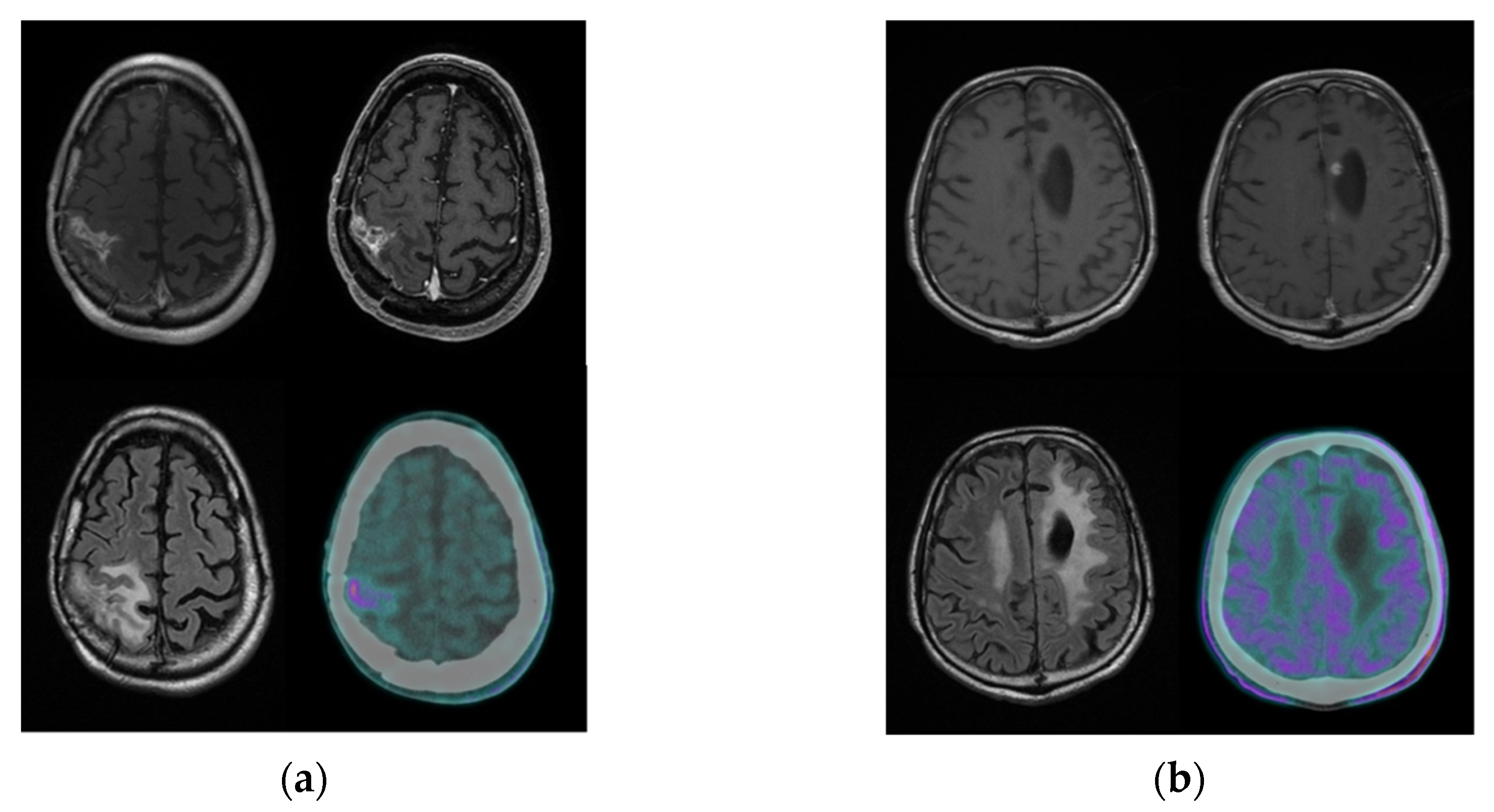 Cancers 13 04777 g004