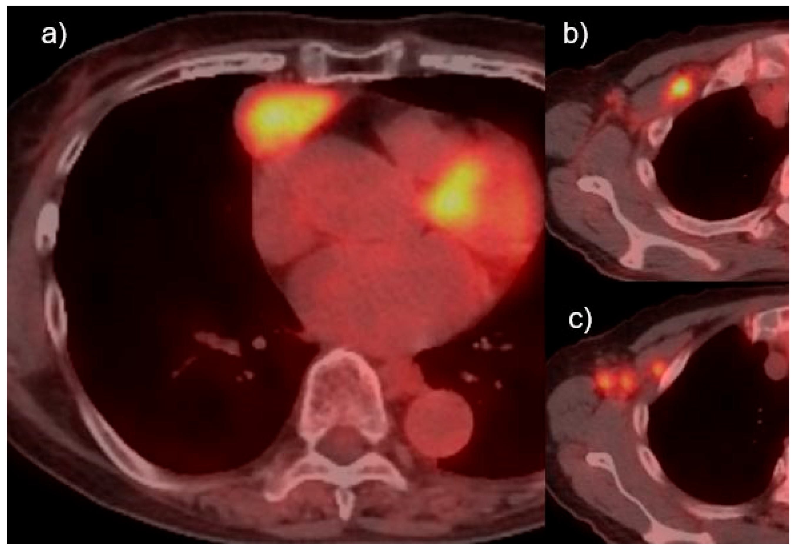 Cancers 13 04794 g003 Cancers 13 04794 g003