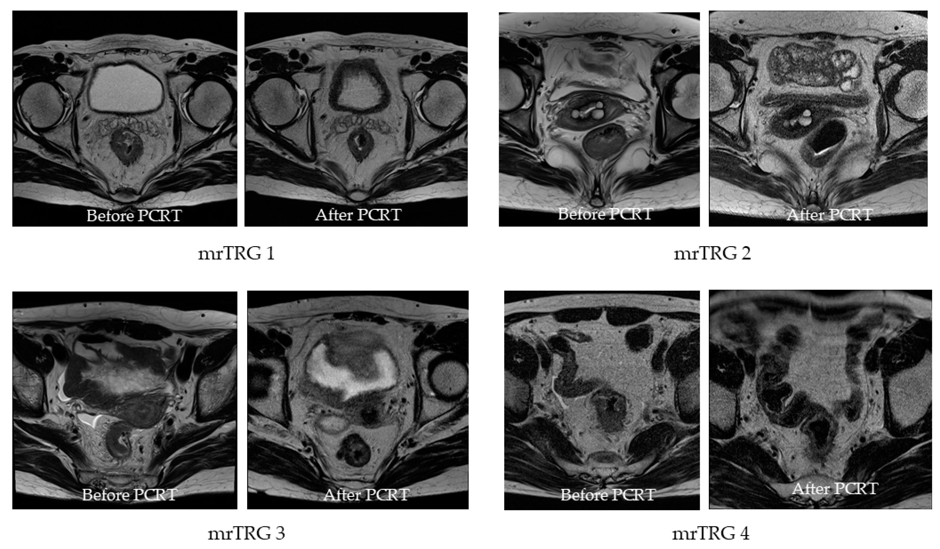 Cancers 13 04823 g002