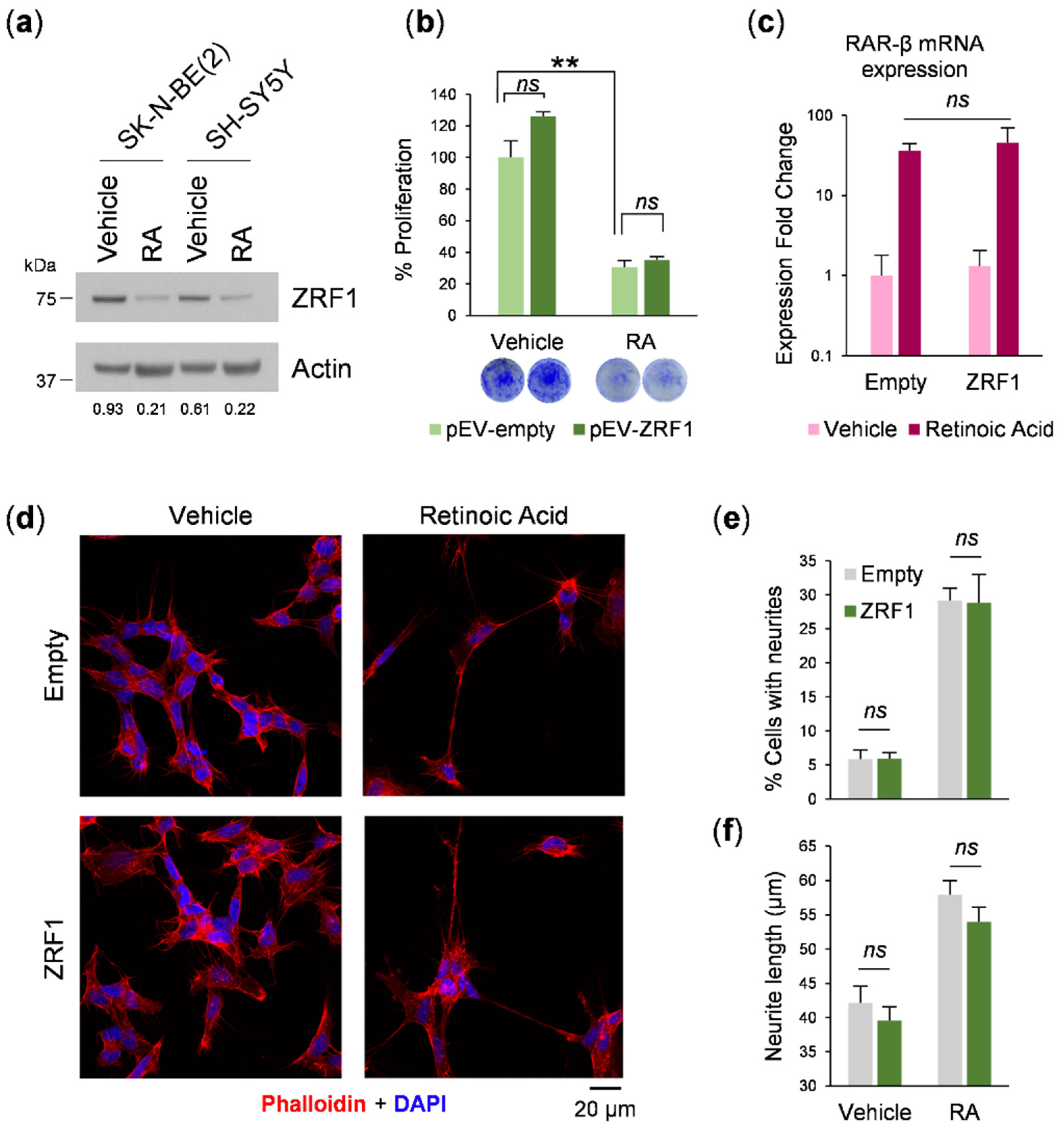 Cancers 13 04845 g004 Cancers 13 04845 g004