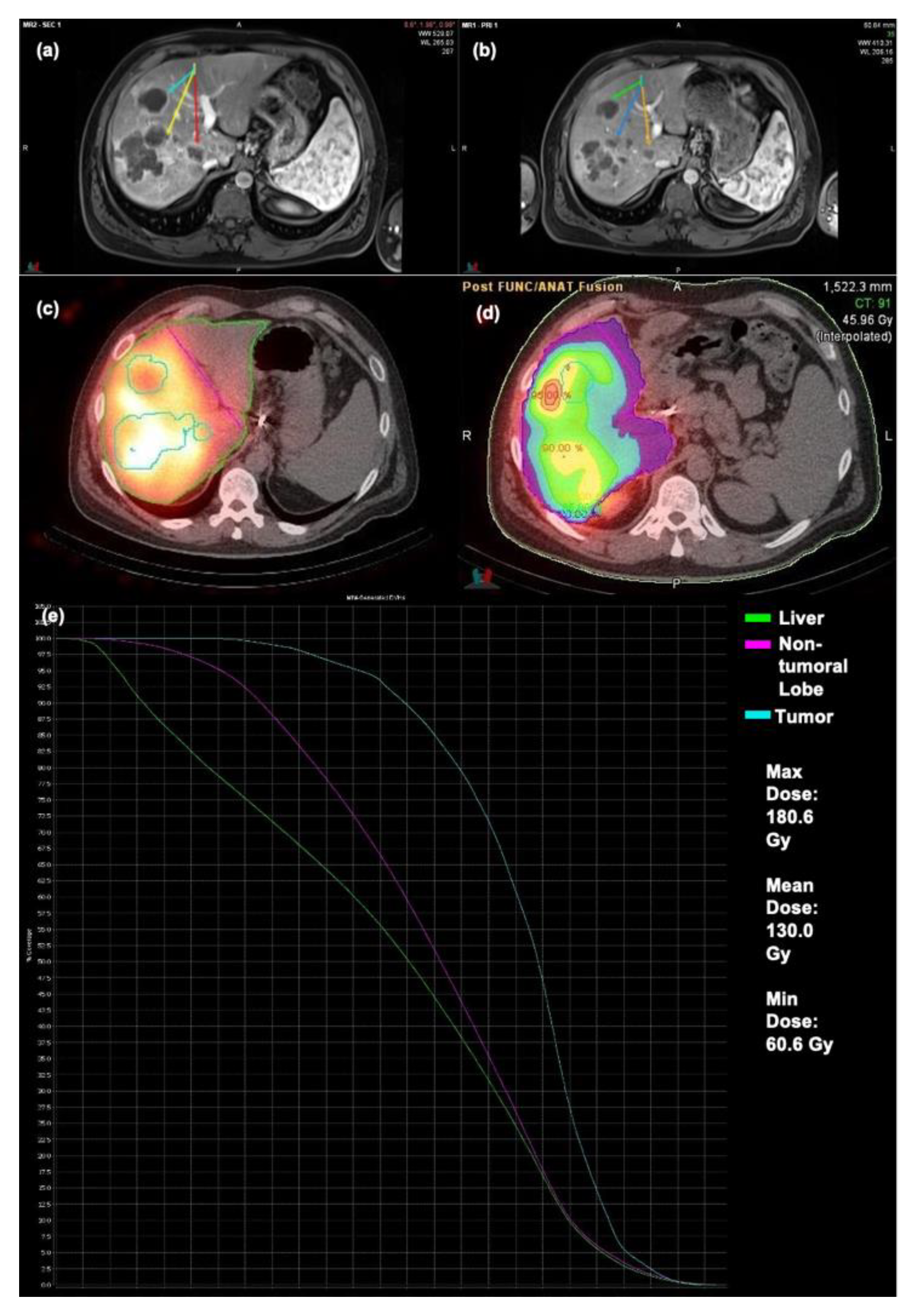 Cancers 13 04908 g004