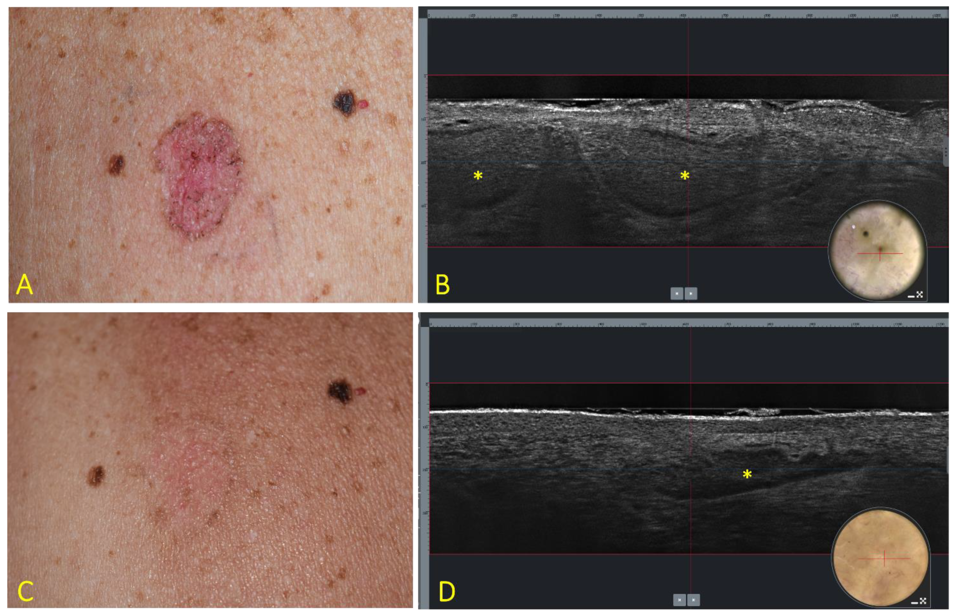 Cancers 13 04913 g002