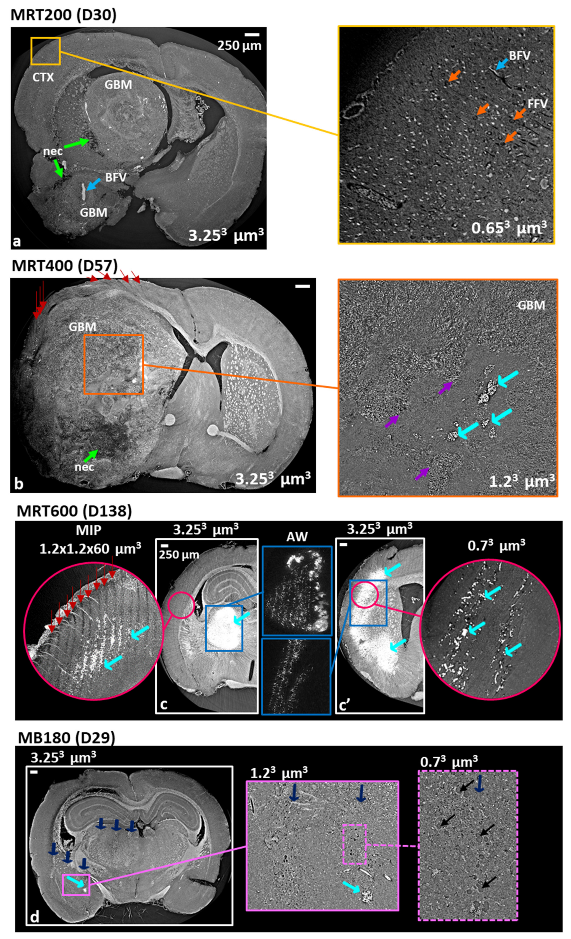 Cancers 13 04953 g005 Cancers 13 04953 g005