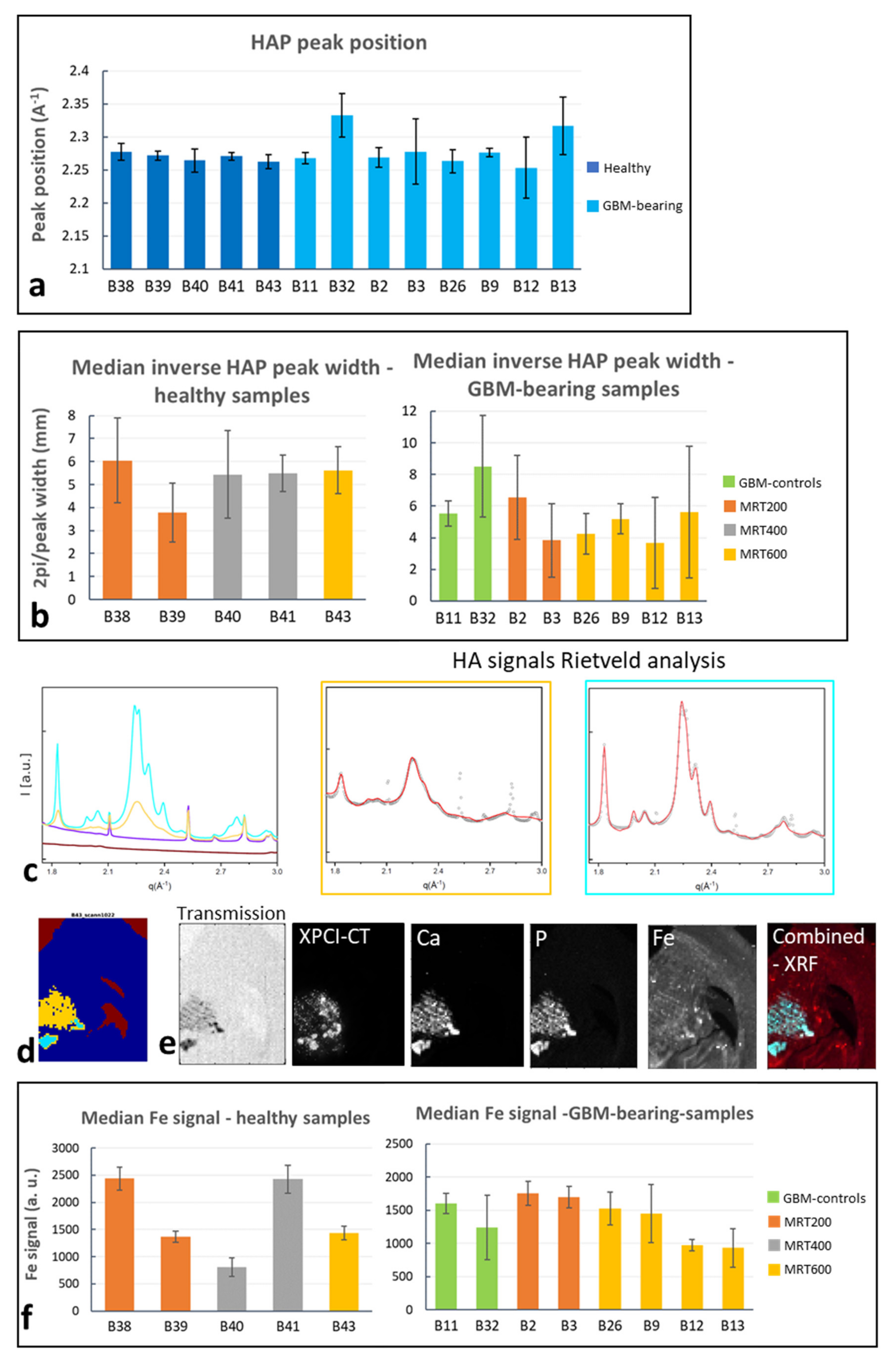 Cancers 13 04953 g009 Cancers 13 04953 g009