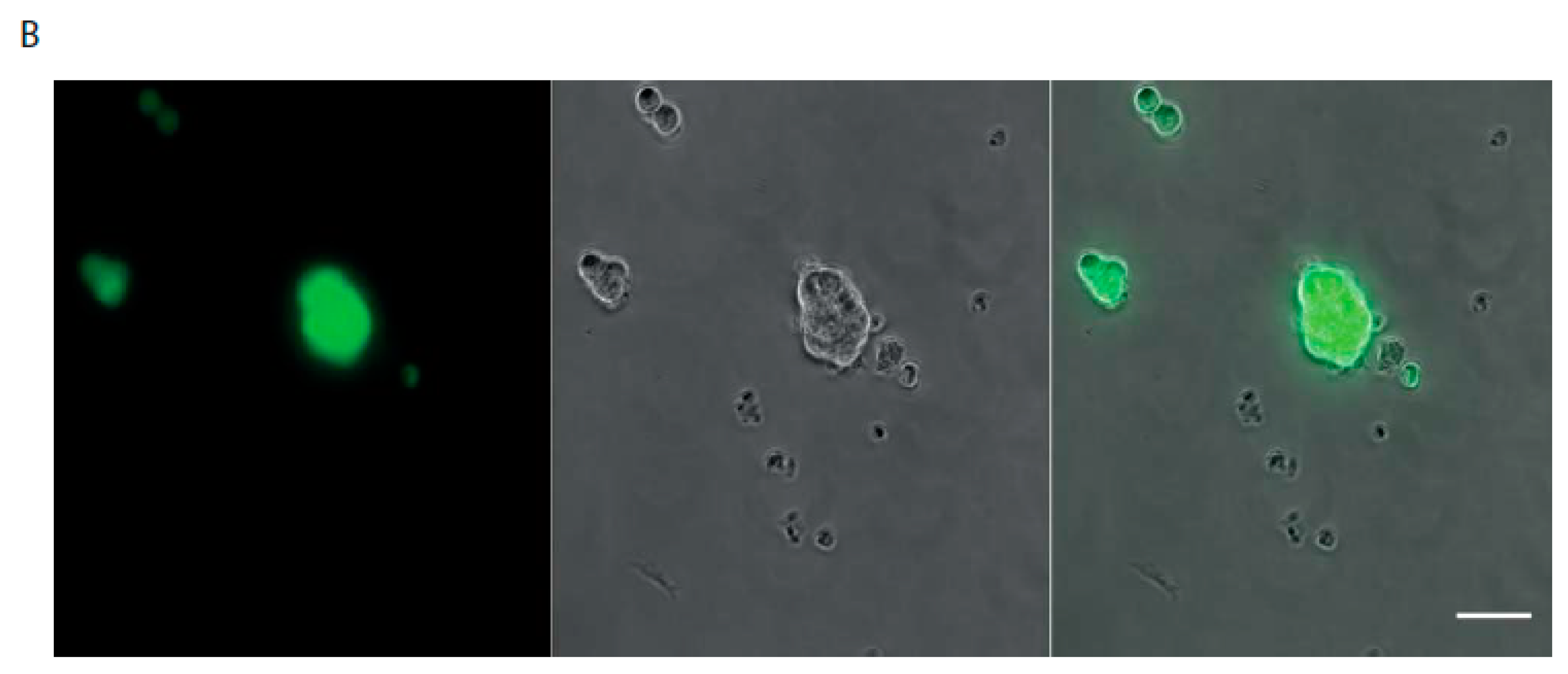 Cancers 13 04966 g003b