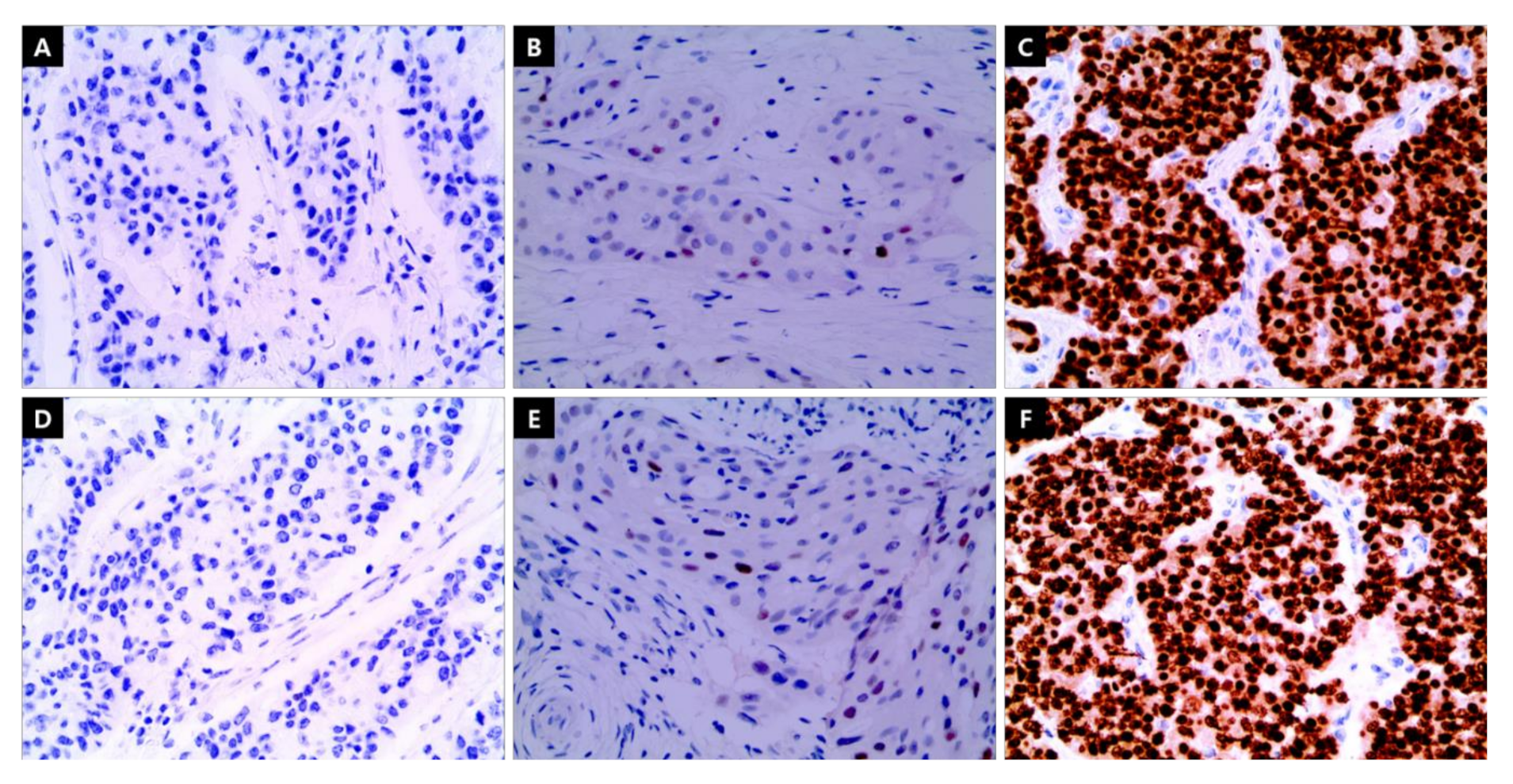 Cancers 13 05007 g002 550