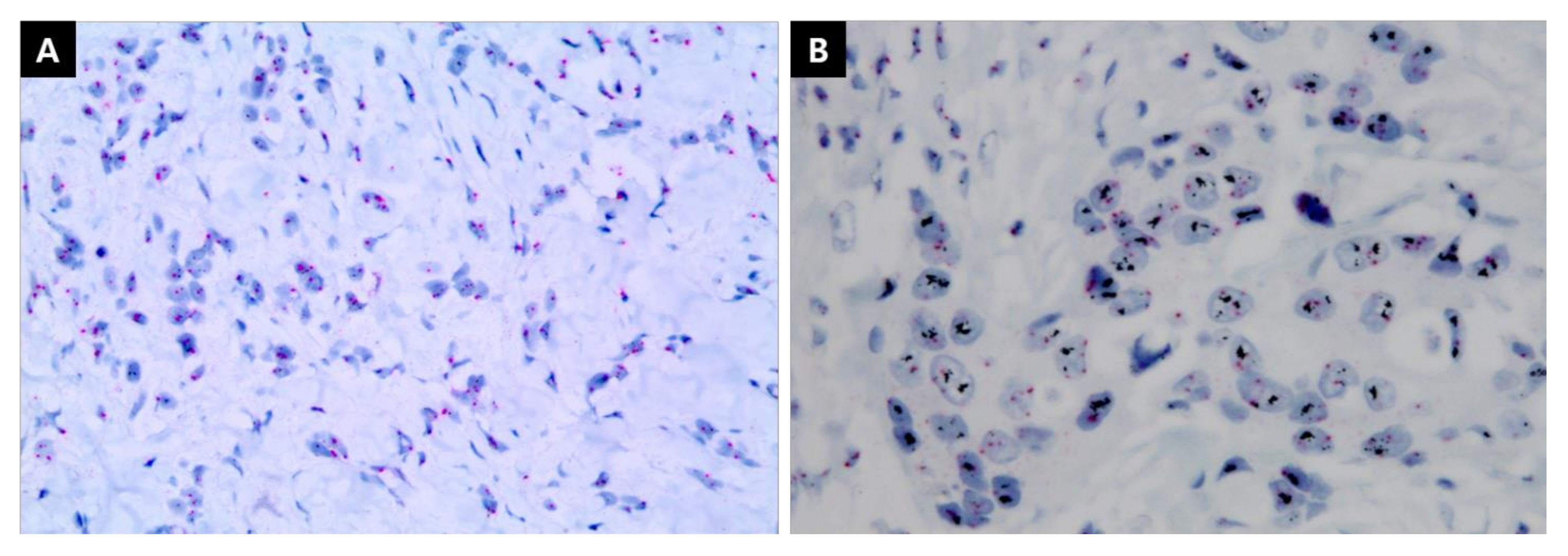 Cancers 13 05007 g005 550