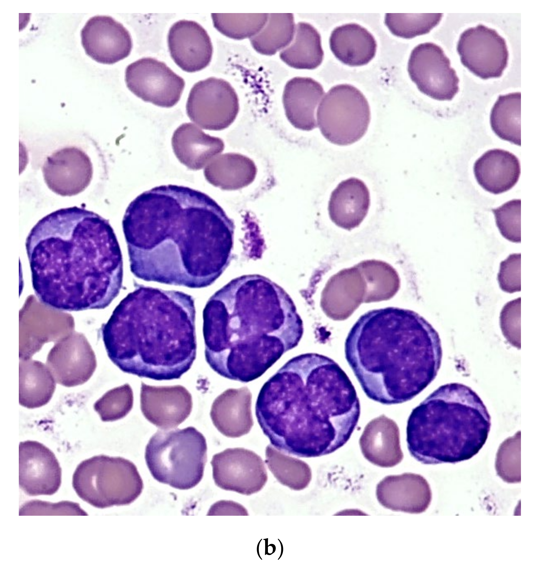 Cancers 13 05078 g003b