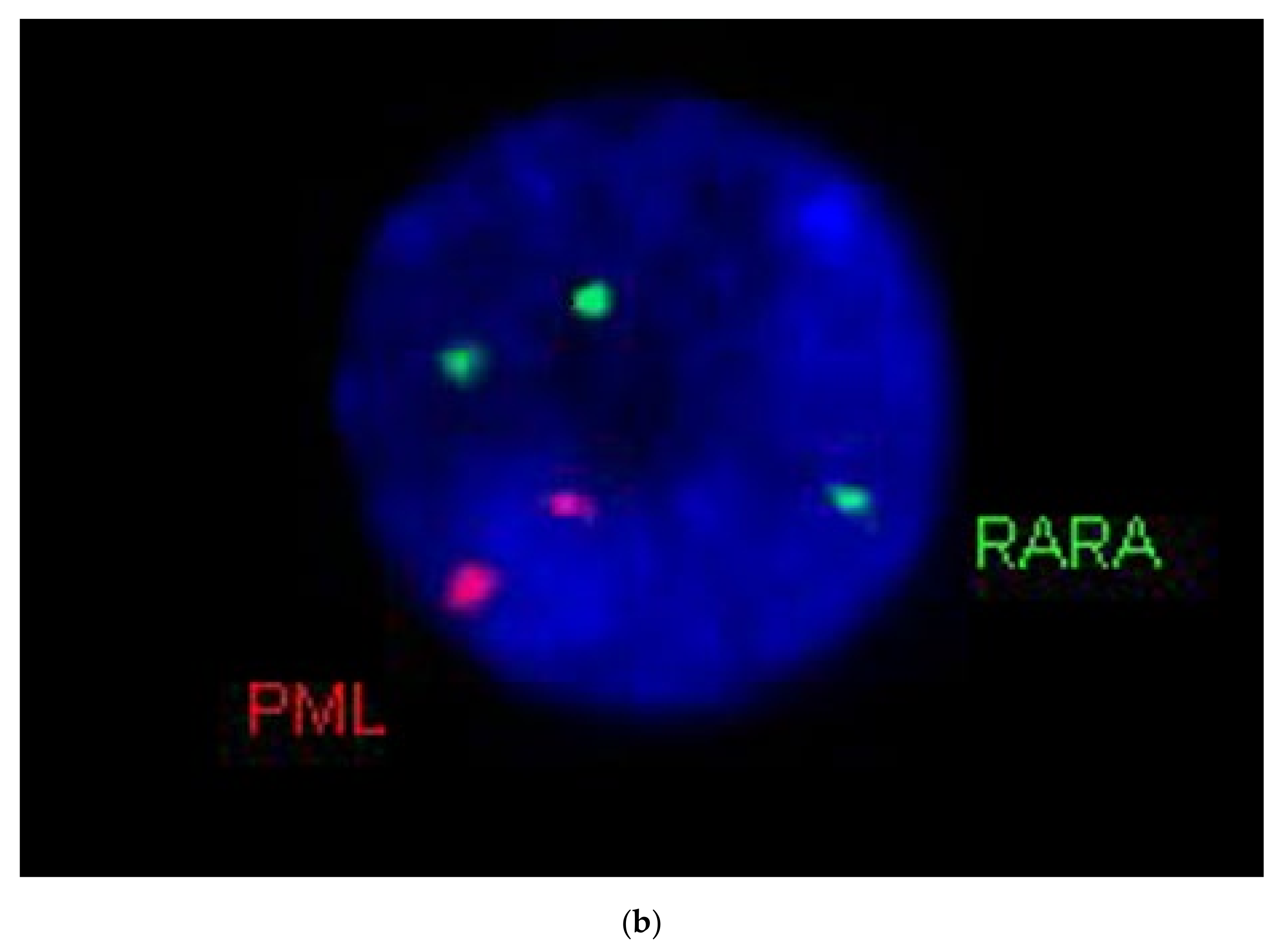 Cancers 13 05078 g005b