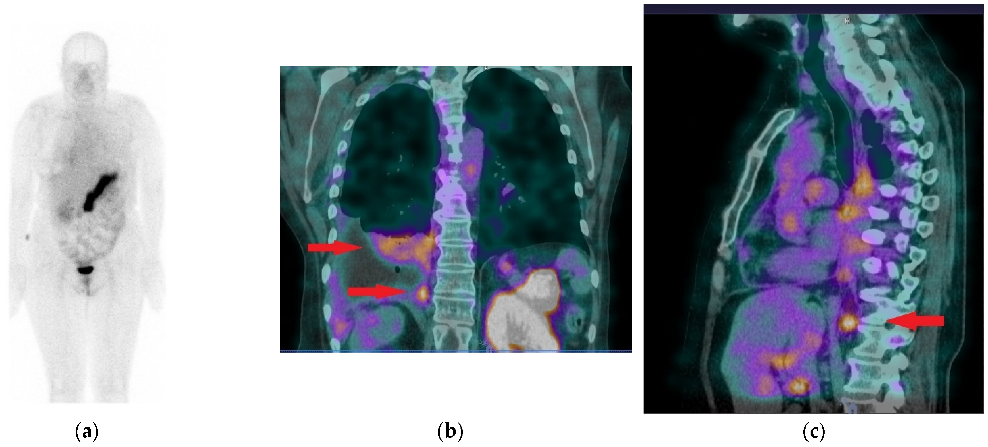 Cancers 13 05093 g007