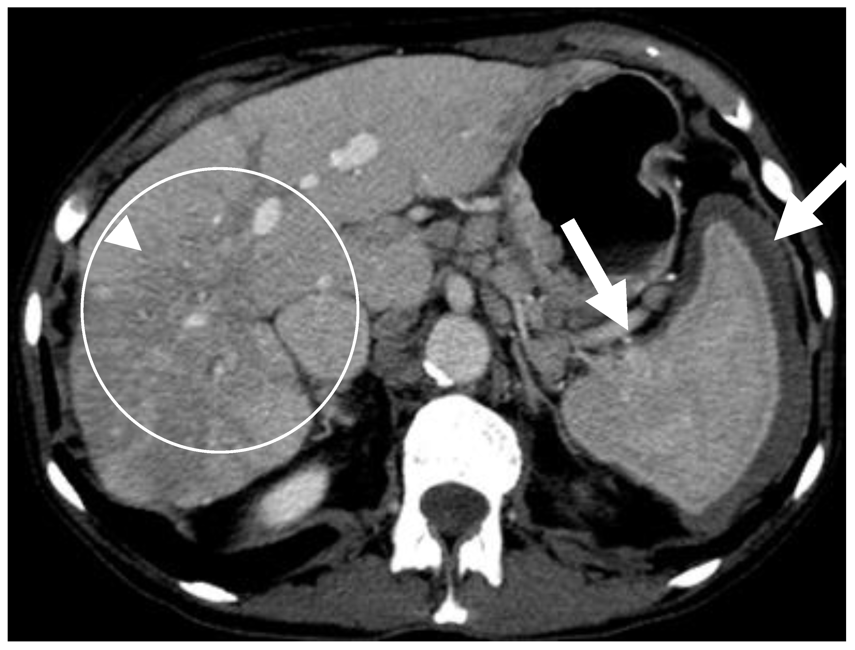 Cancers 13 05102 g004