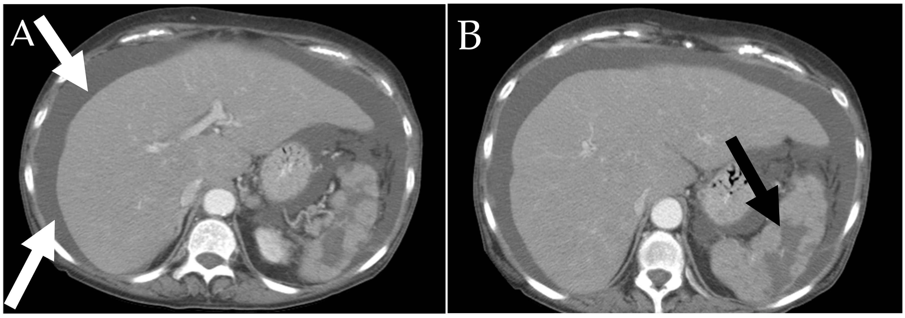 Cancers 13 05102 g005