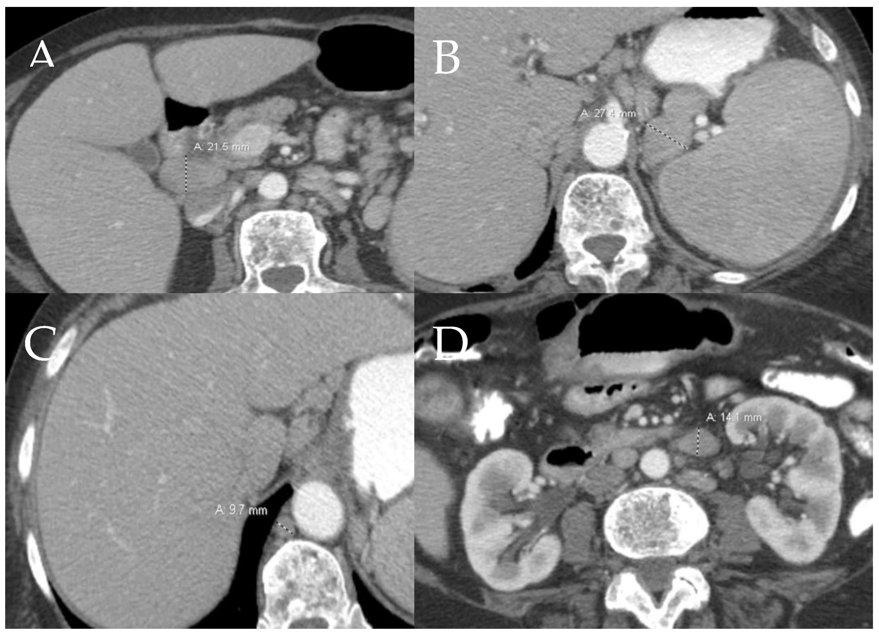 Cancers 13 05102 g006