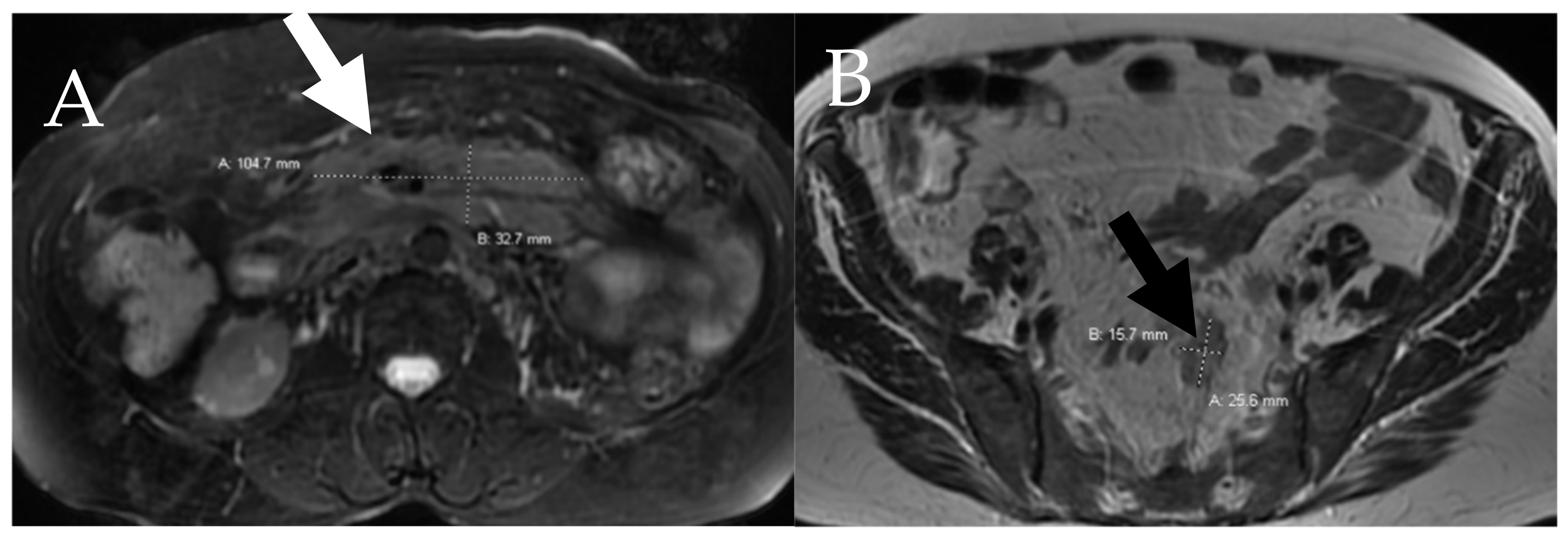 Cancers 13 05102 g007