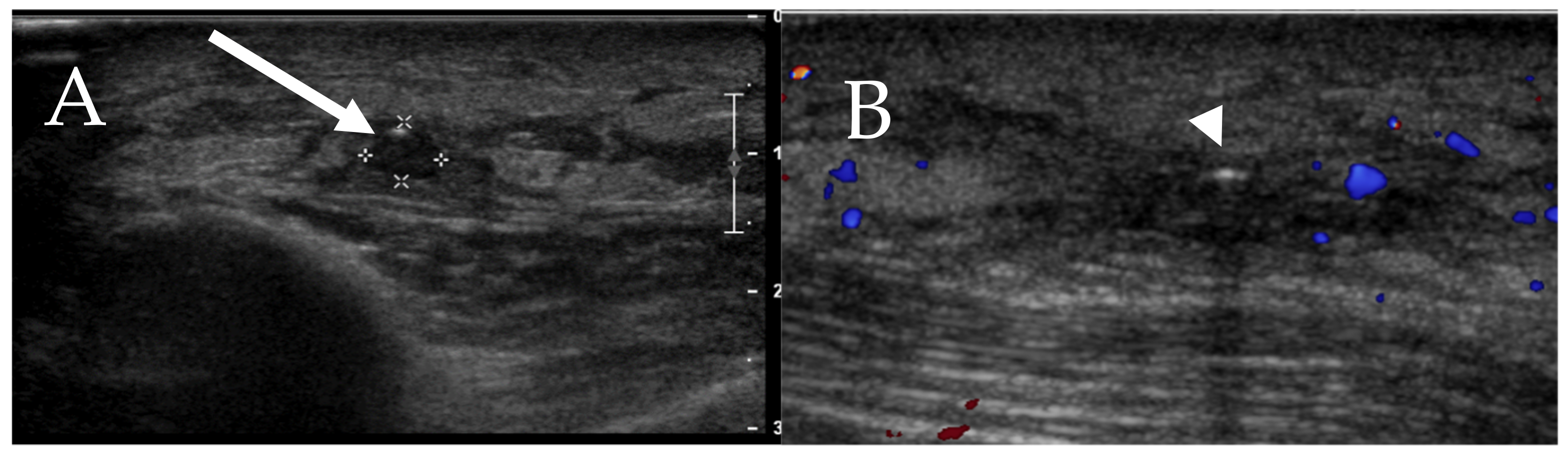 Cancers 13 05102 g009