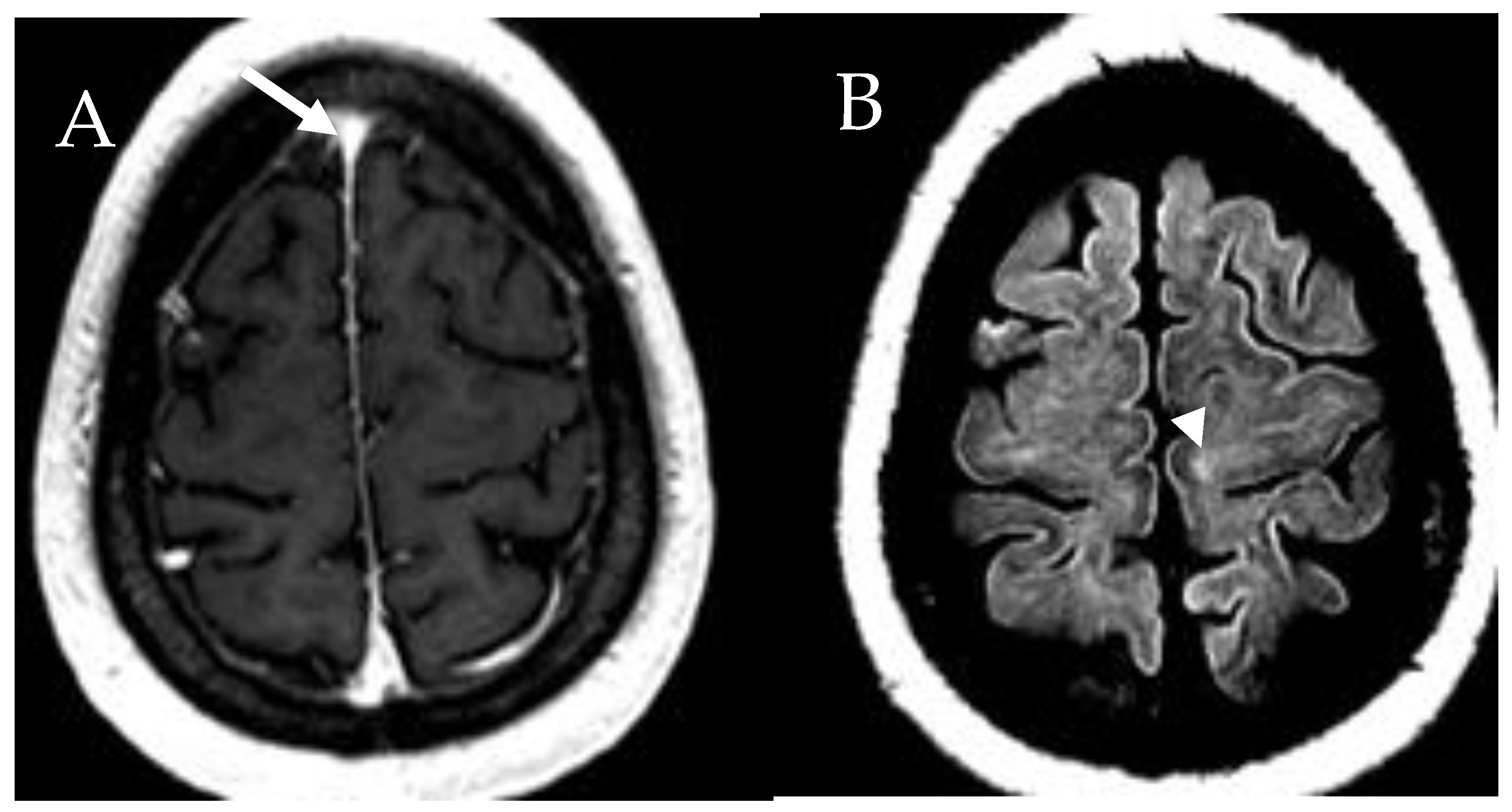 Cancers 13 05102 g010