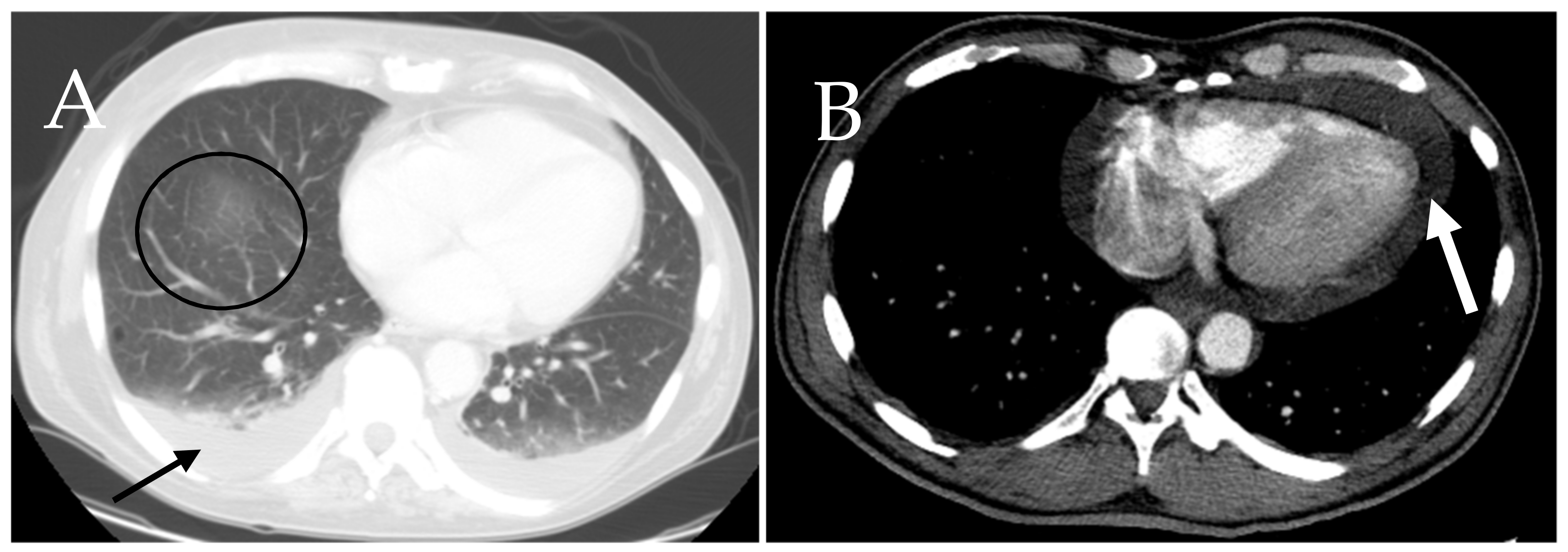 Cancers 13 05102 g011