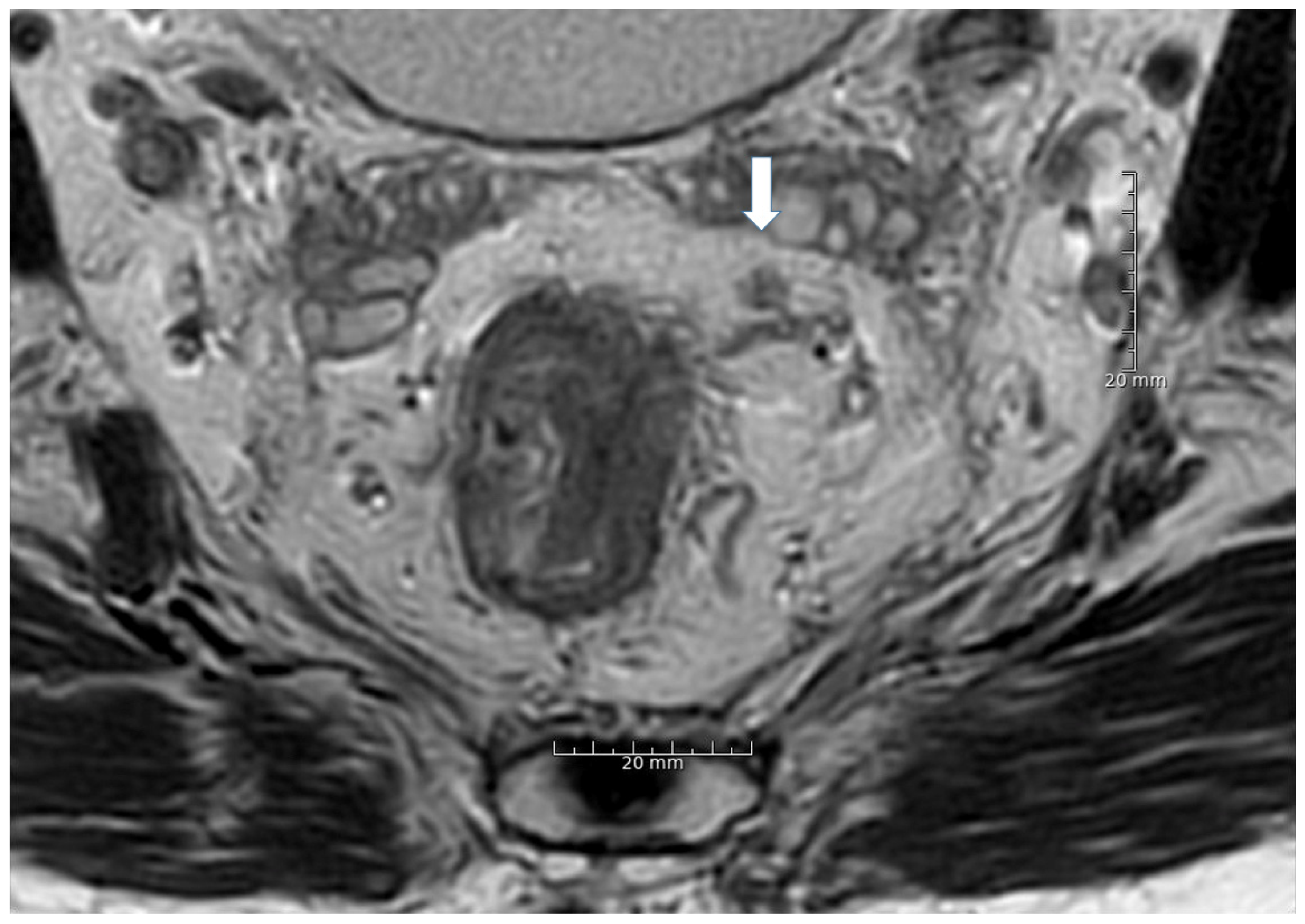 Cancers 13 05120 g002 550