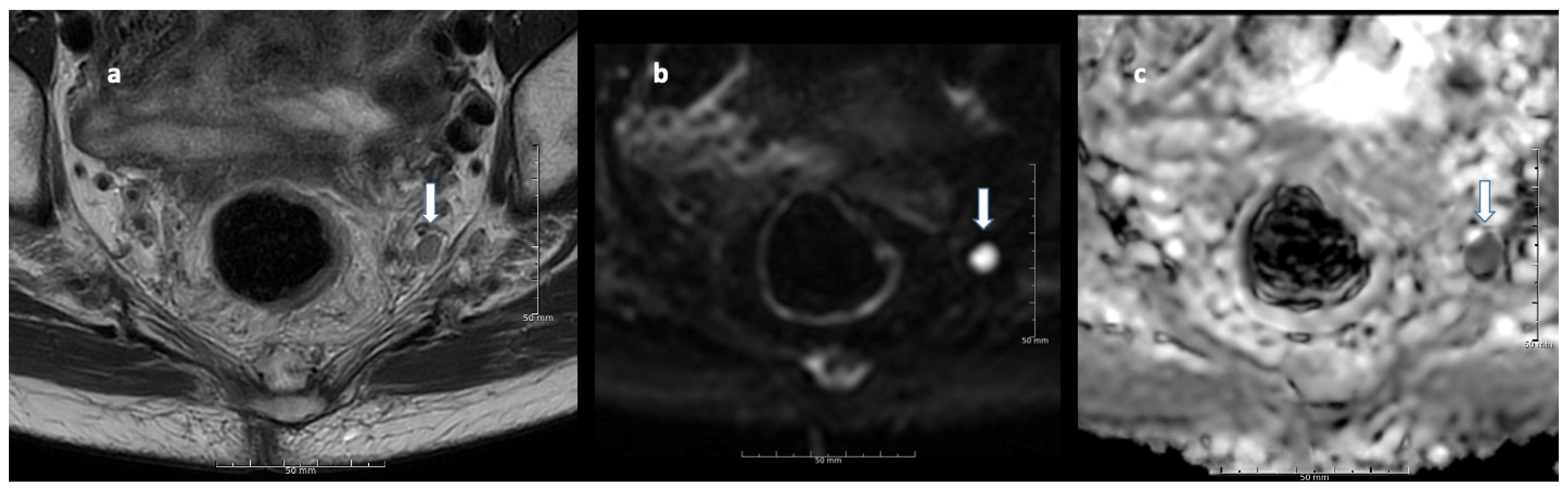 Cancers 13 05120 g004 550