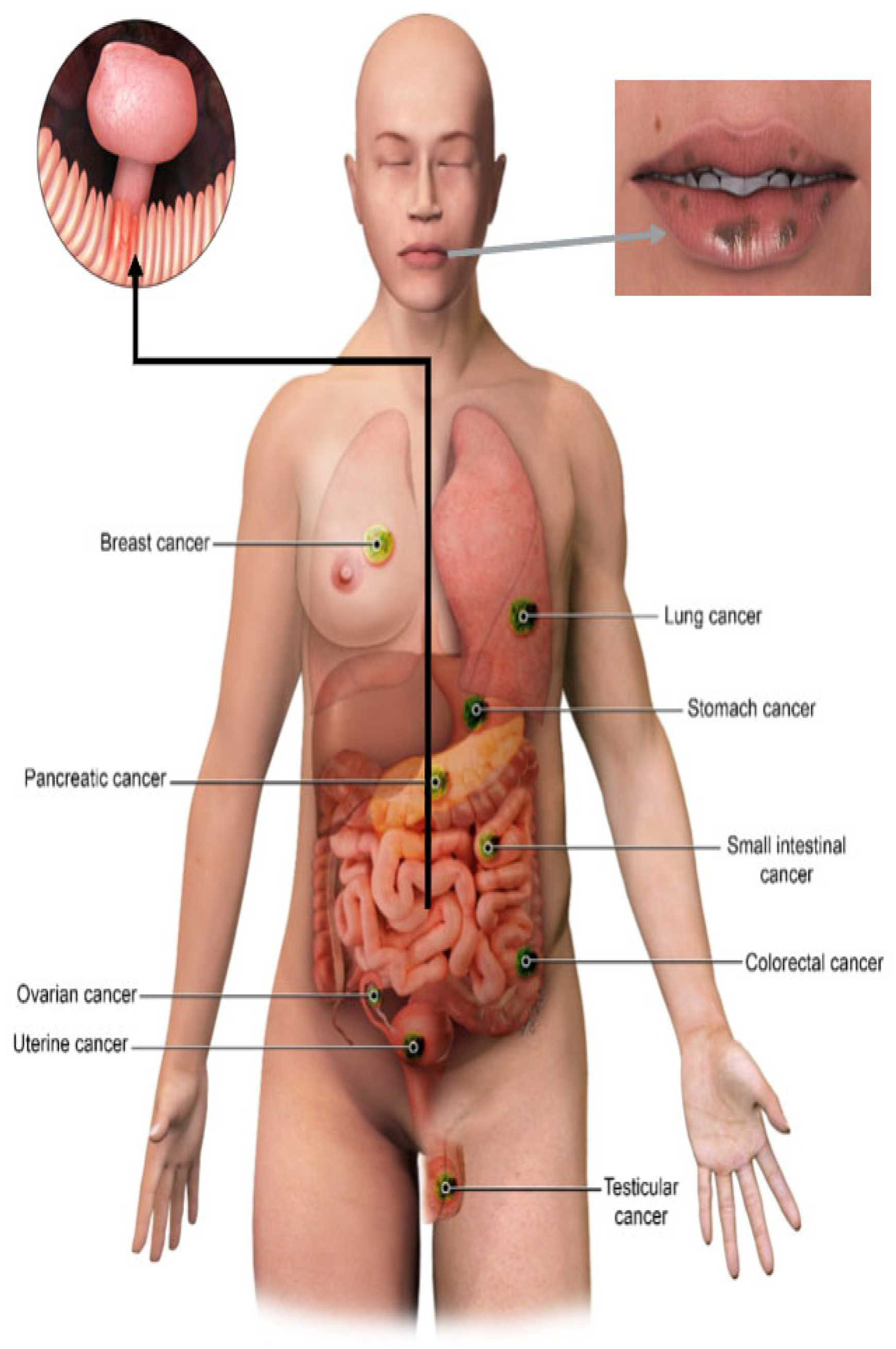 Cancers 13 05121 g001
