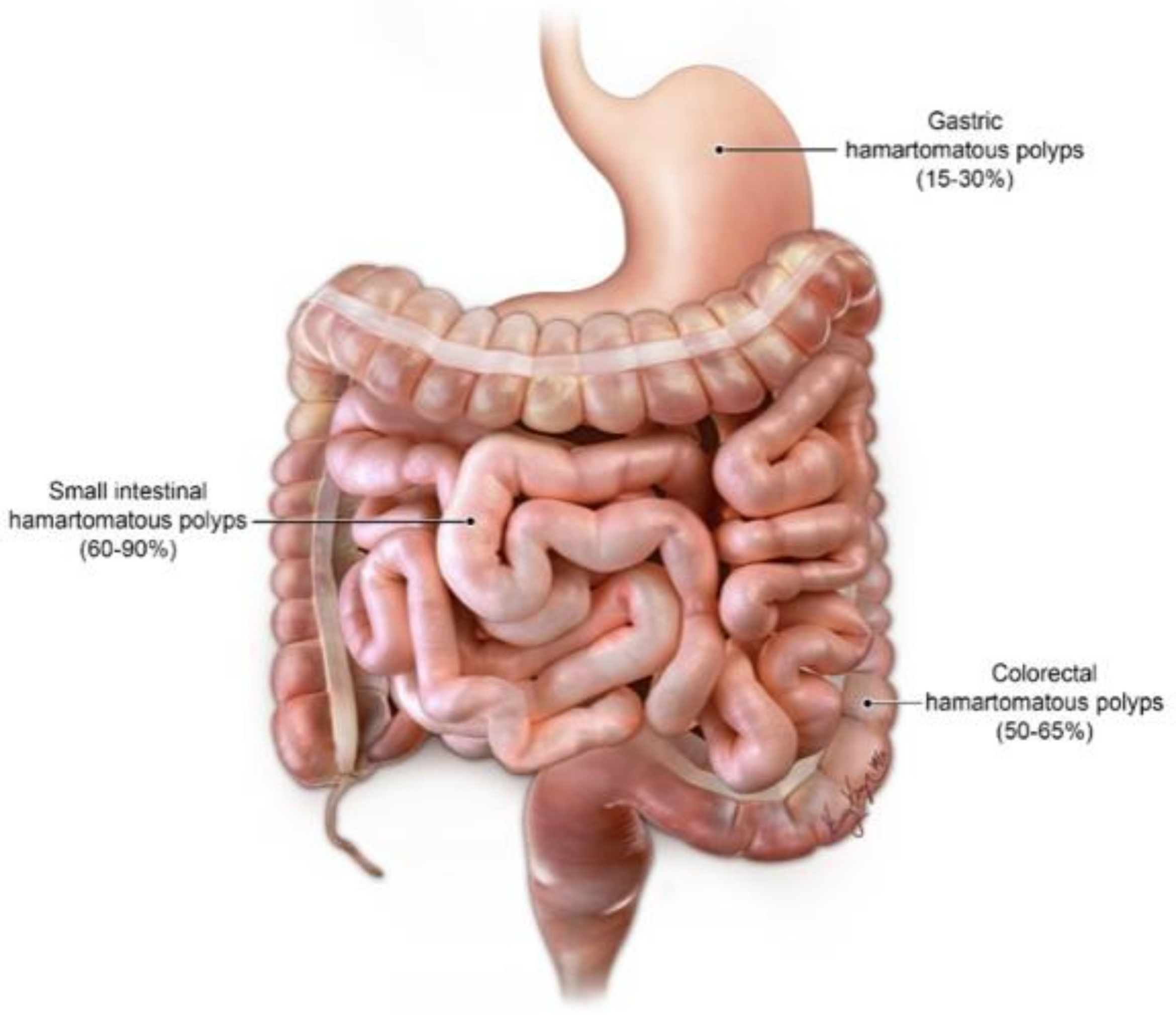 Cancers 13 05121 g004